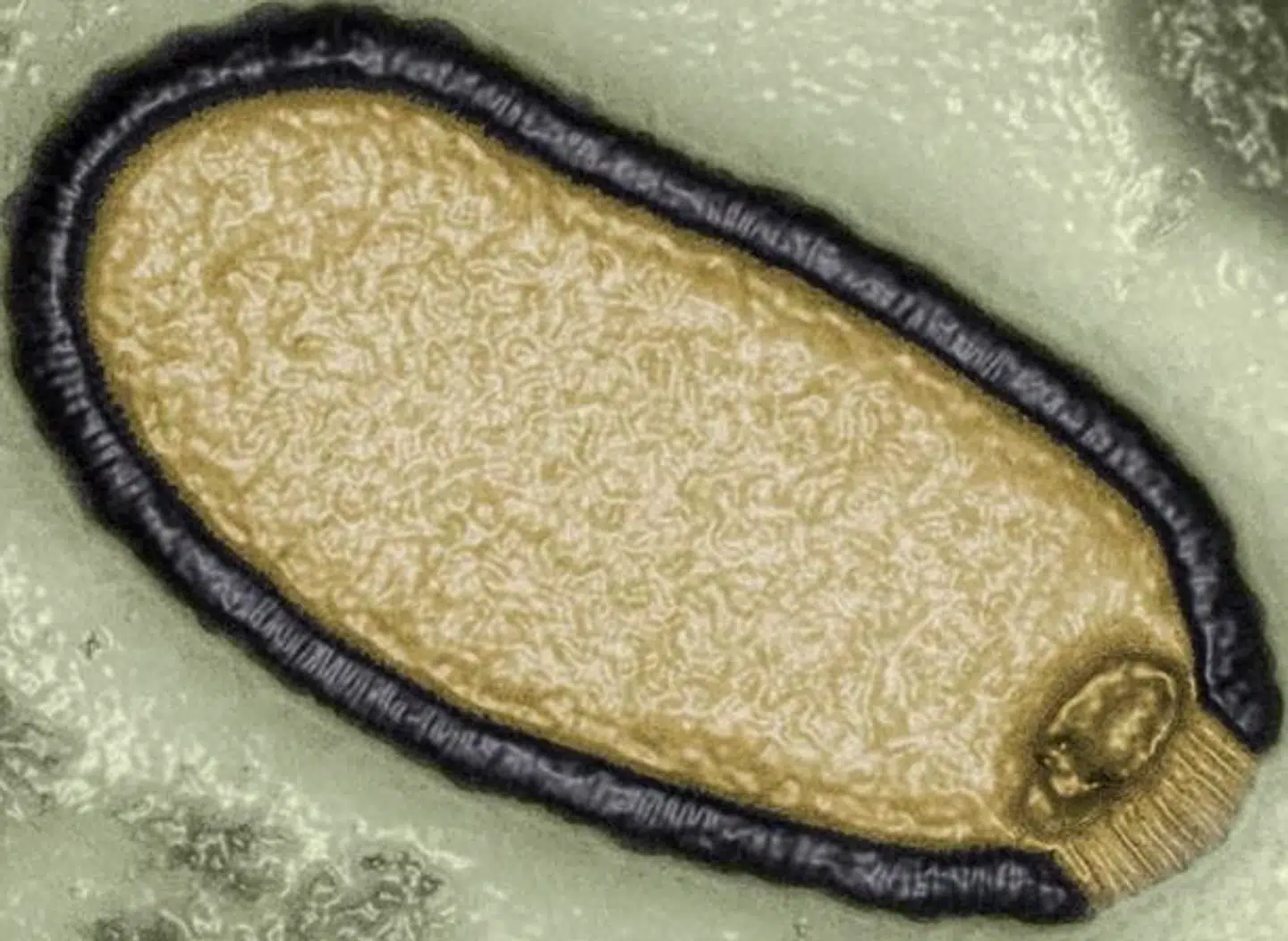 Et opskaleret foto fra 2014 viser et eksempel på Pithovirus, som blev fundet i Sibiriens permafrost.