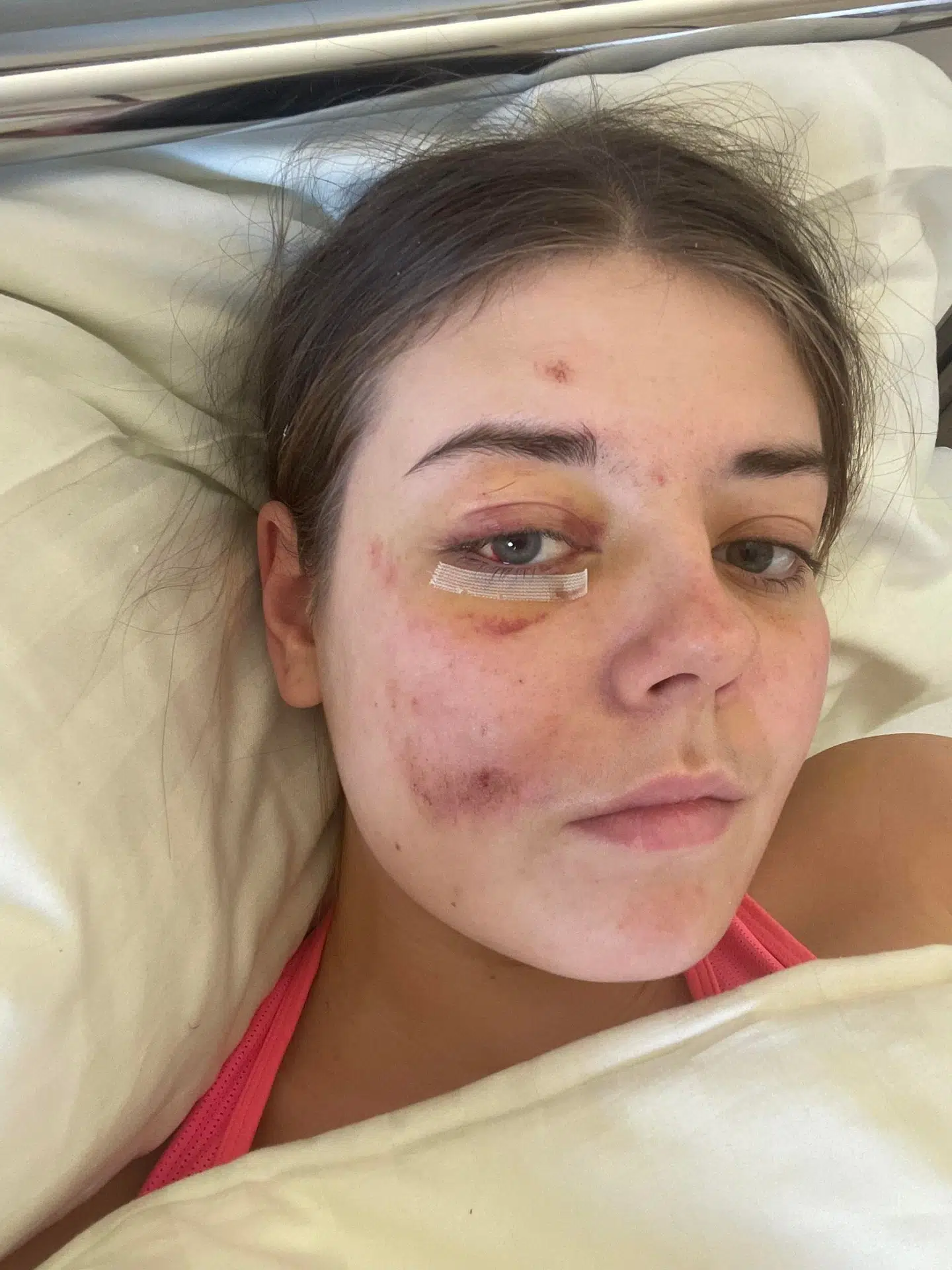 19-årige Sofia Lindvig befandt sig i den gondol, der tidligere i januar styrtede ned i Østrig.