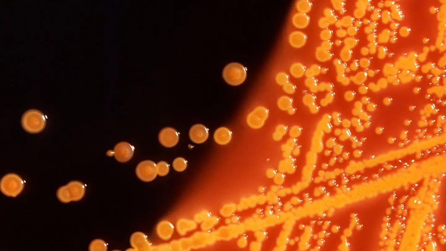 Amerikanske forskere har gjort sig en helt ny opdagelse, der kan forklare komplikationer vedrørende corona virus.