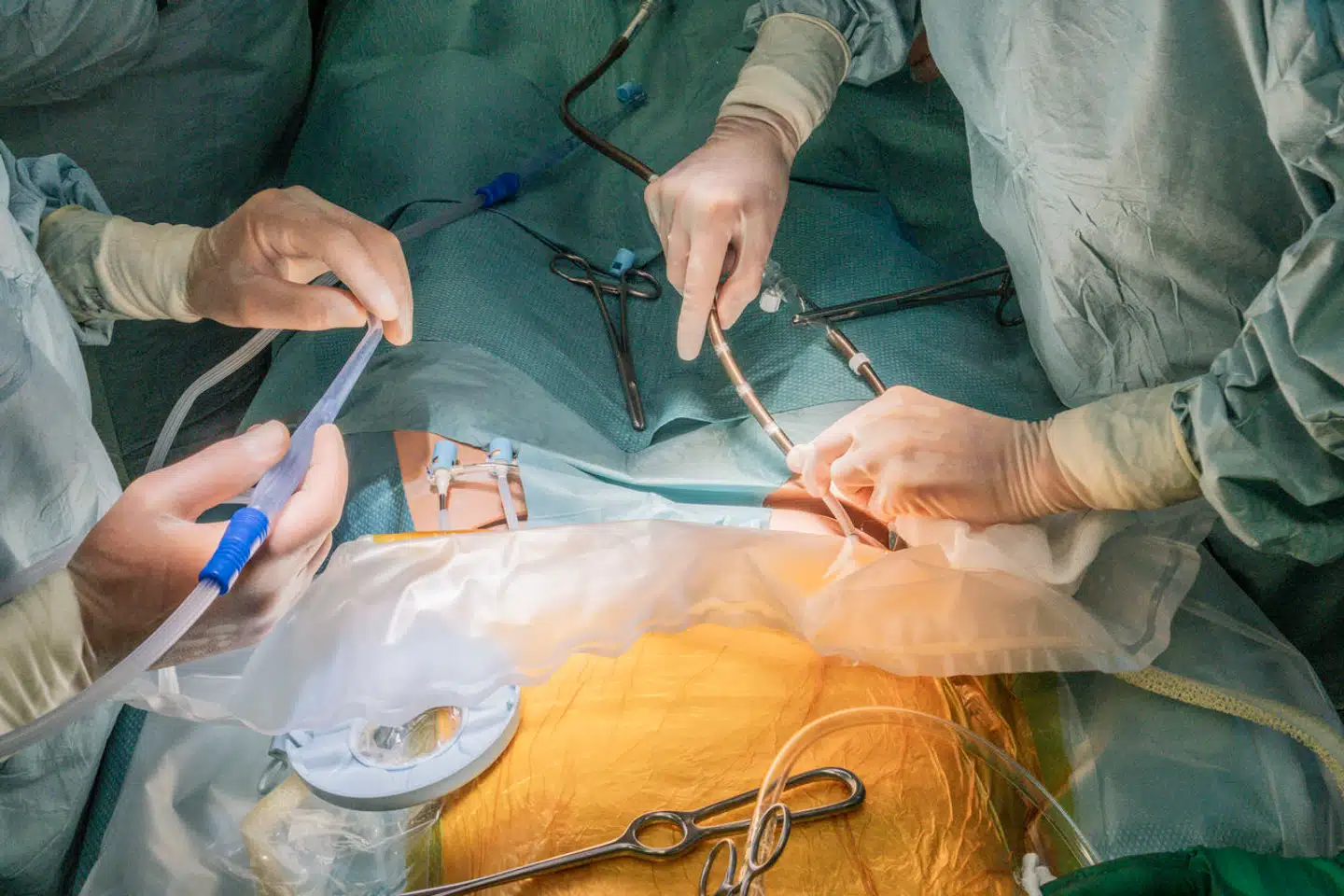 Rigshospitalets specialister i organtransplantation og organdonation øver sig på de nye procedurer. Regeringen vil automatisk gøre alle over 18 år til donorer.