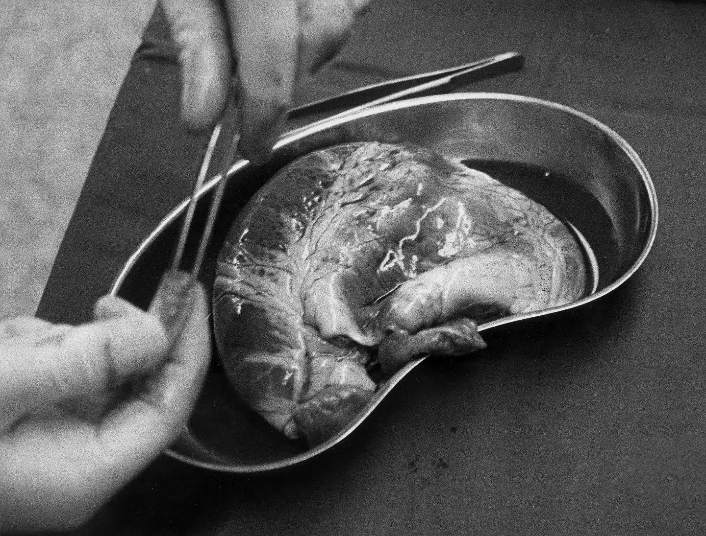 Arkivfoto: Medical Institute Hannover, Scanpix