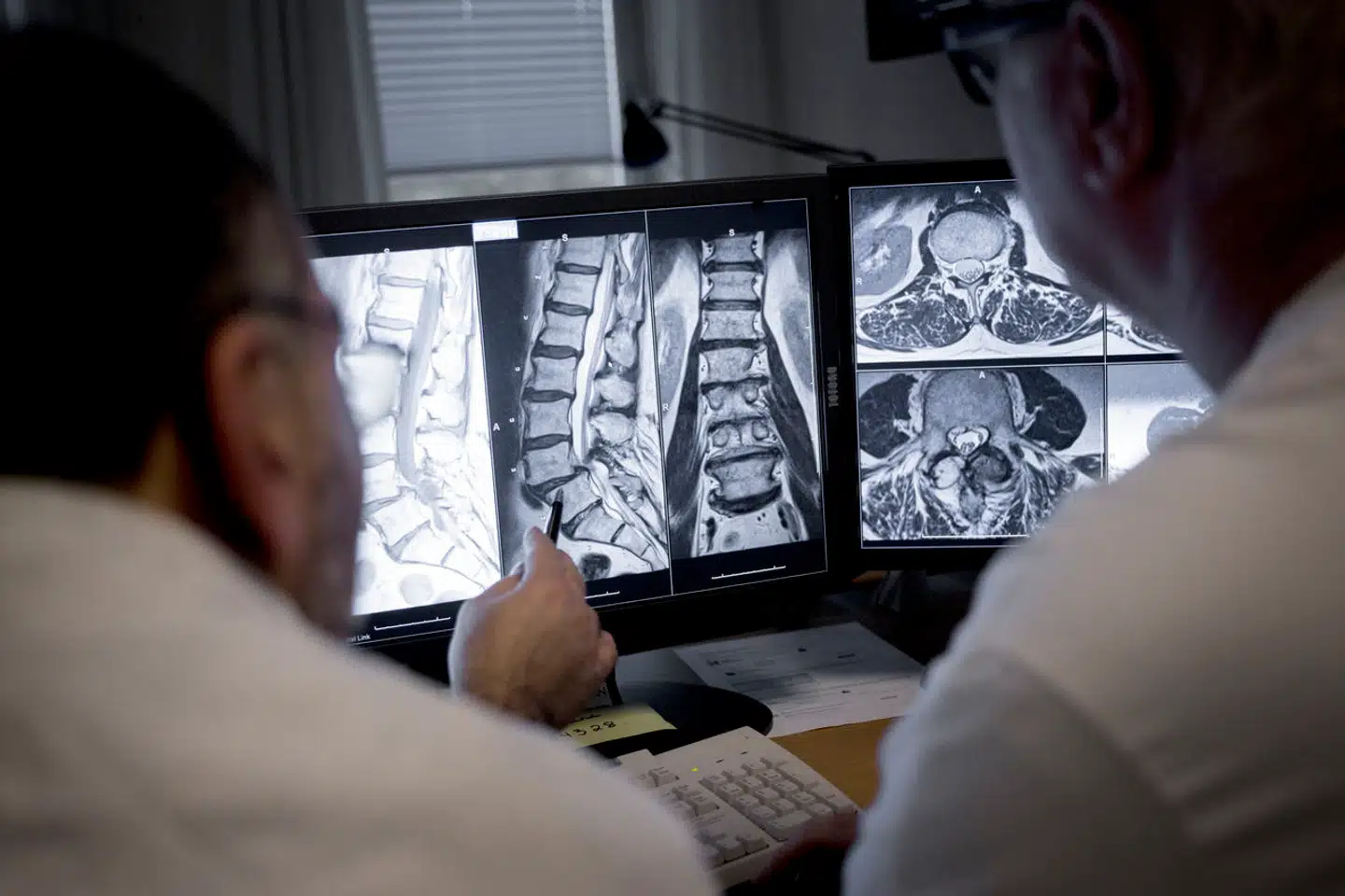 Røntgenbilleder på skadestuerne i Nordjylland har nu fået en virtuel franskmand som medlæser. Det er alle glade for.