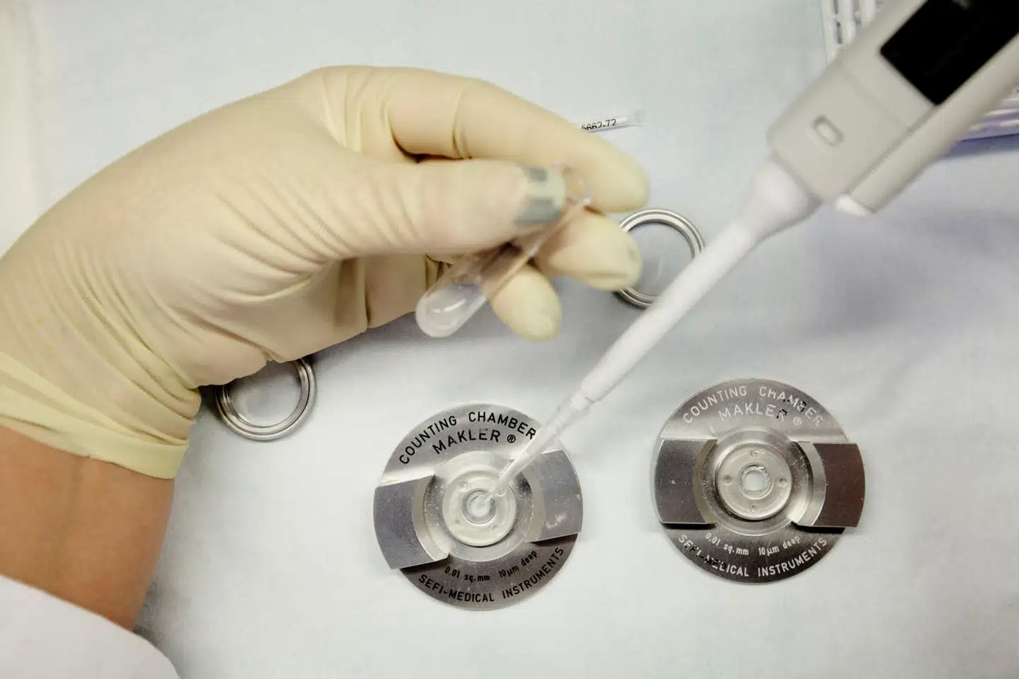 I delstaten Alabama har en ny dom bragt fertilitetsbehandling i farezonen. Det er konsekvensen af, at delstaten definerer, at livet begynder med befrugtningen.