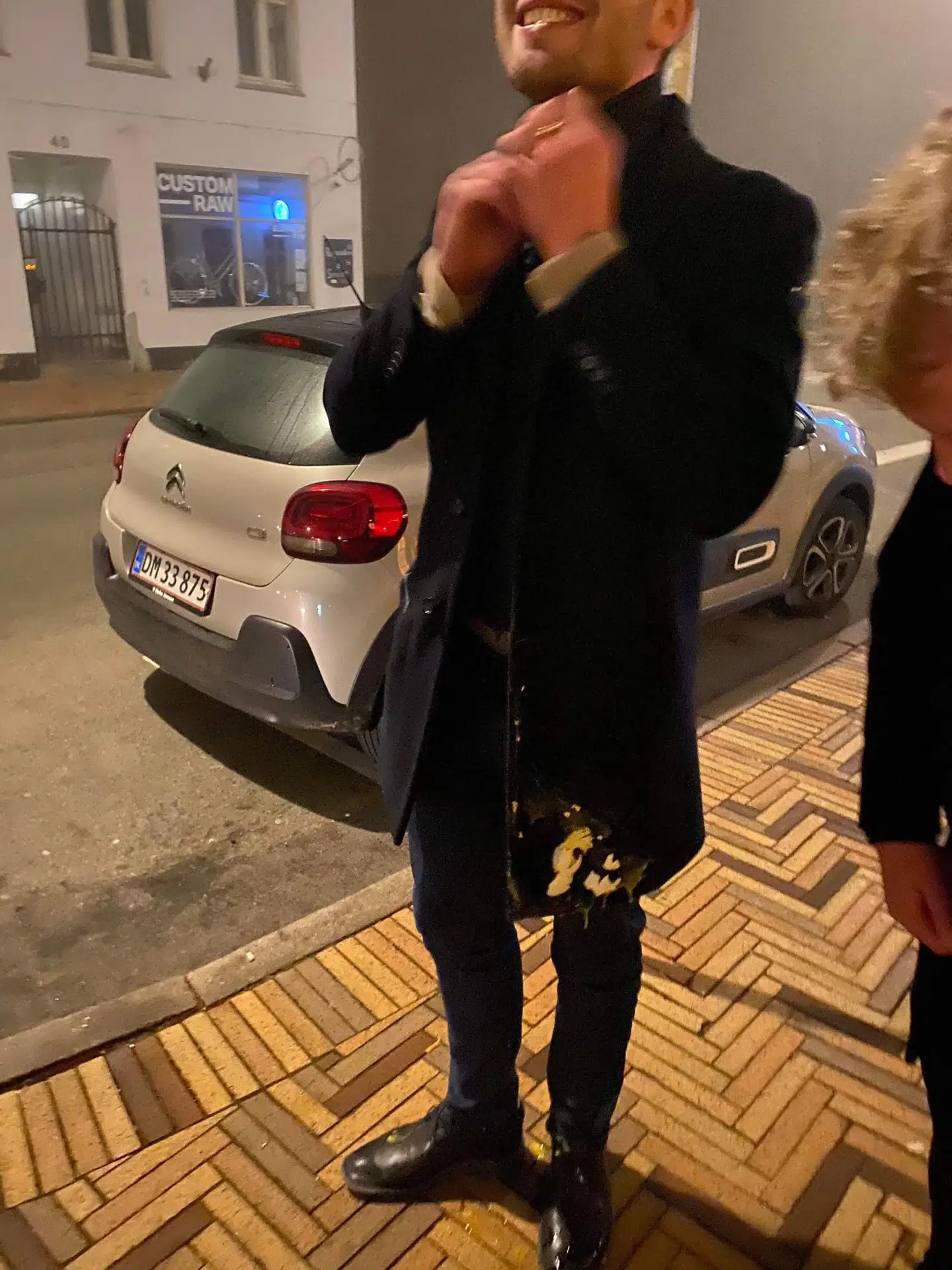 Her kan du se hvordan Christoffer Lilleholts tøj så ud efter han var blevet udsat for det angreb, som han selv kalder 'absurd'.