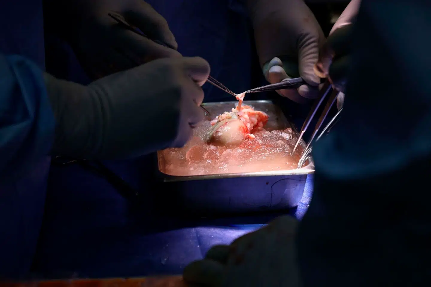 69 genmodificeringer har tilpasset svinenyren til en menneskekrop. Foto: Massachusetts General Hospital.