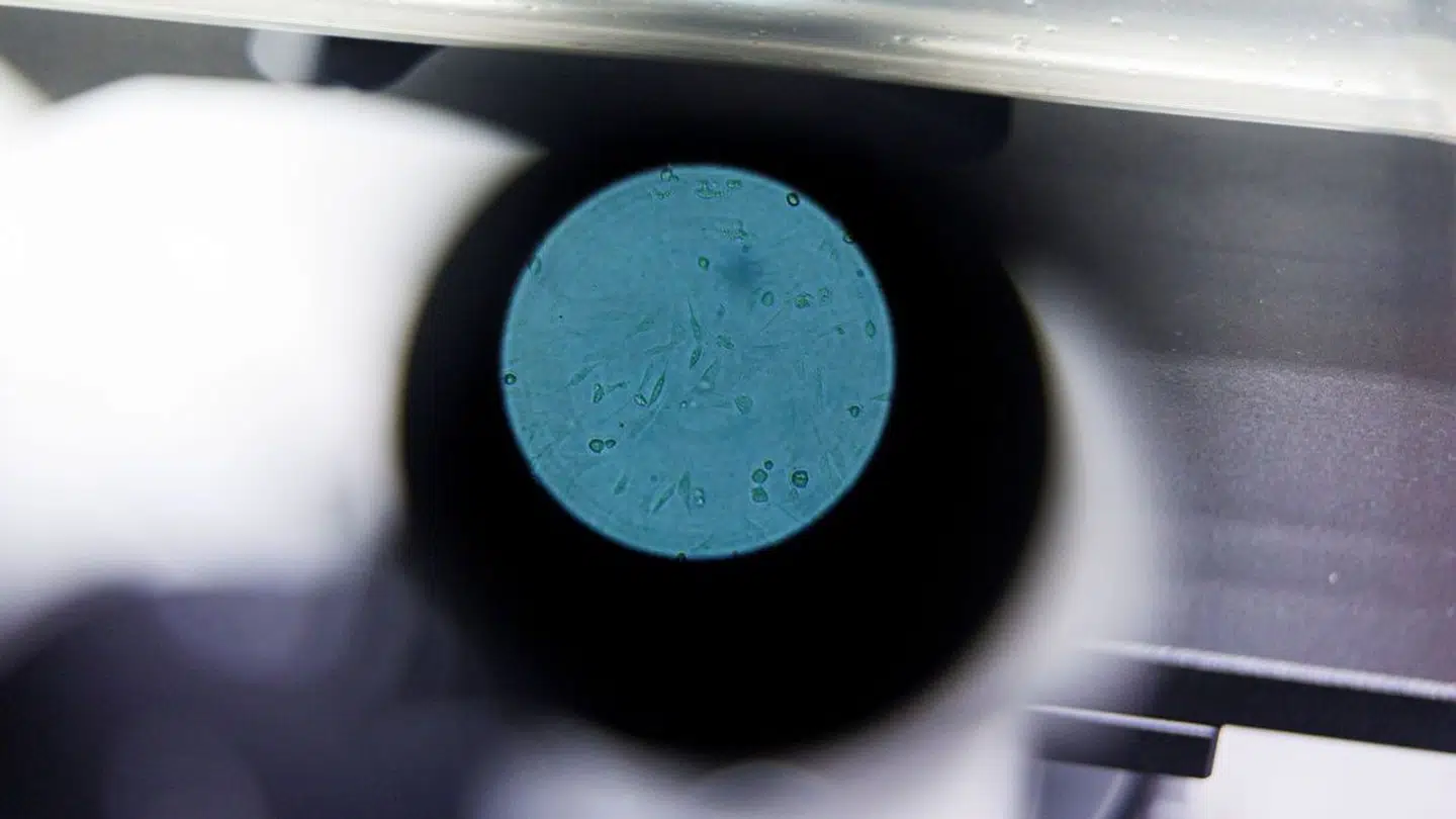 Arkivfoto af en virus under et mikroskop.