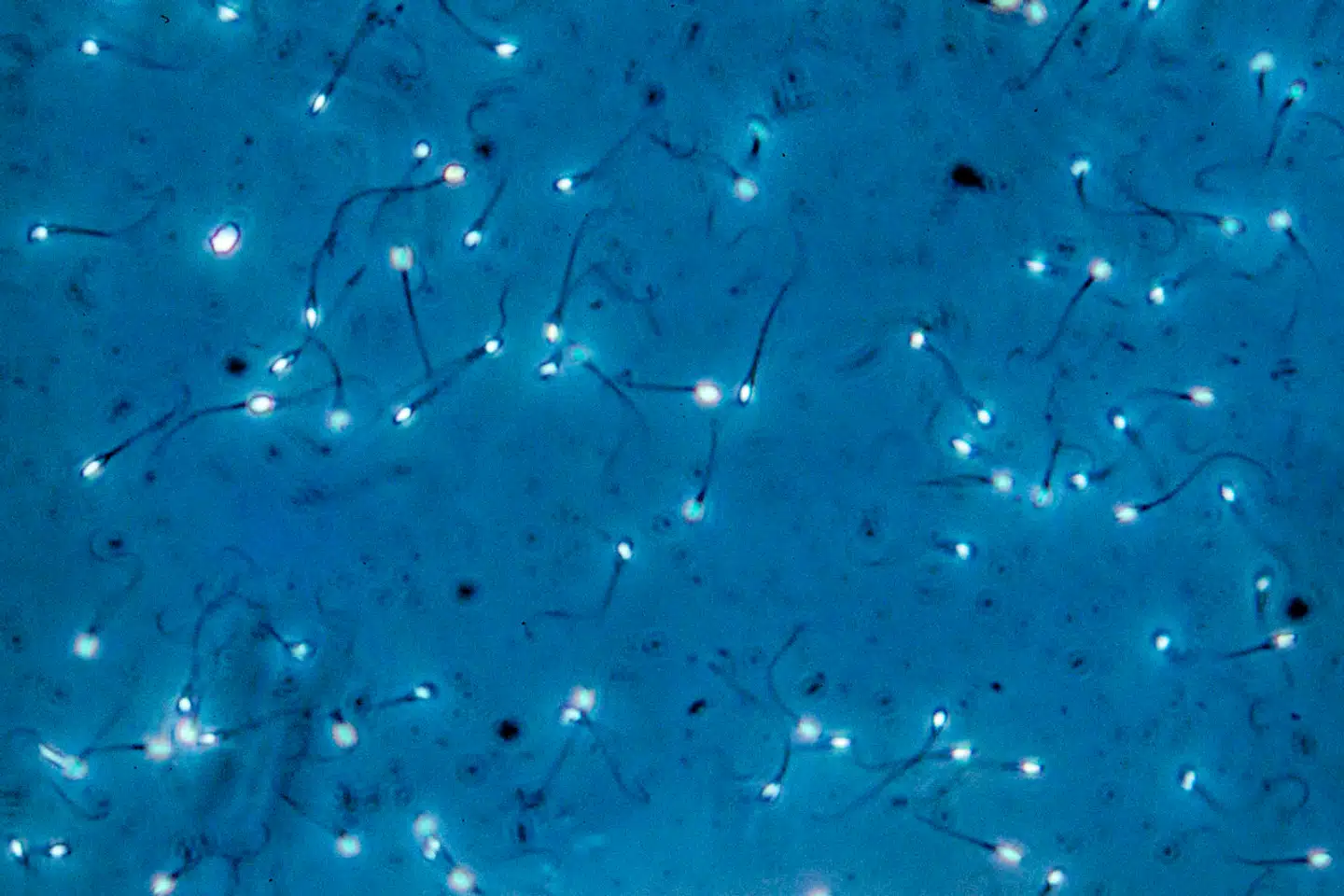 »Donorernes vilkår er skæve. Mens sæddonorer har god og fleksibel adgang til at donere, kan ægdonoren kun bidrage, når der er en modtager klar,« skriver Jakob Axel Nielsen.