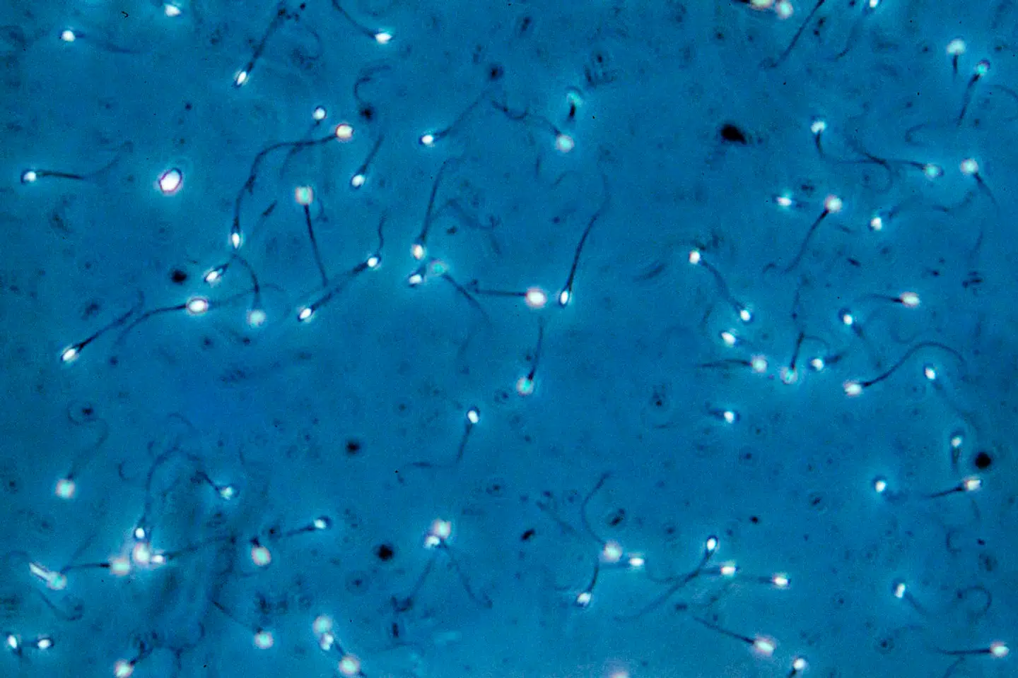 »Donorernes vilkår er skæve. Mens sæddonorer har god og fleksibel adgang til at donere, kan ægdonoren kun bidrage, når der er en modtager klar,« skriver Jakob Axel Nielsen.