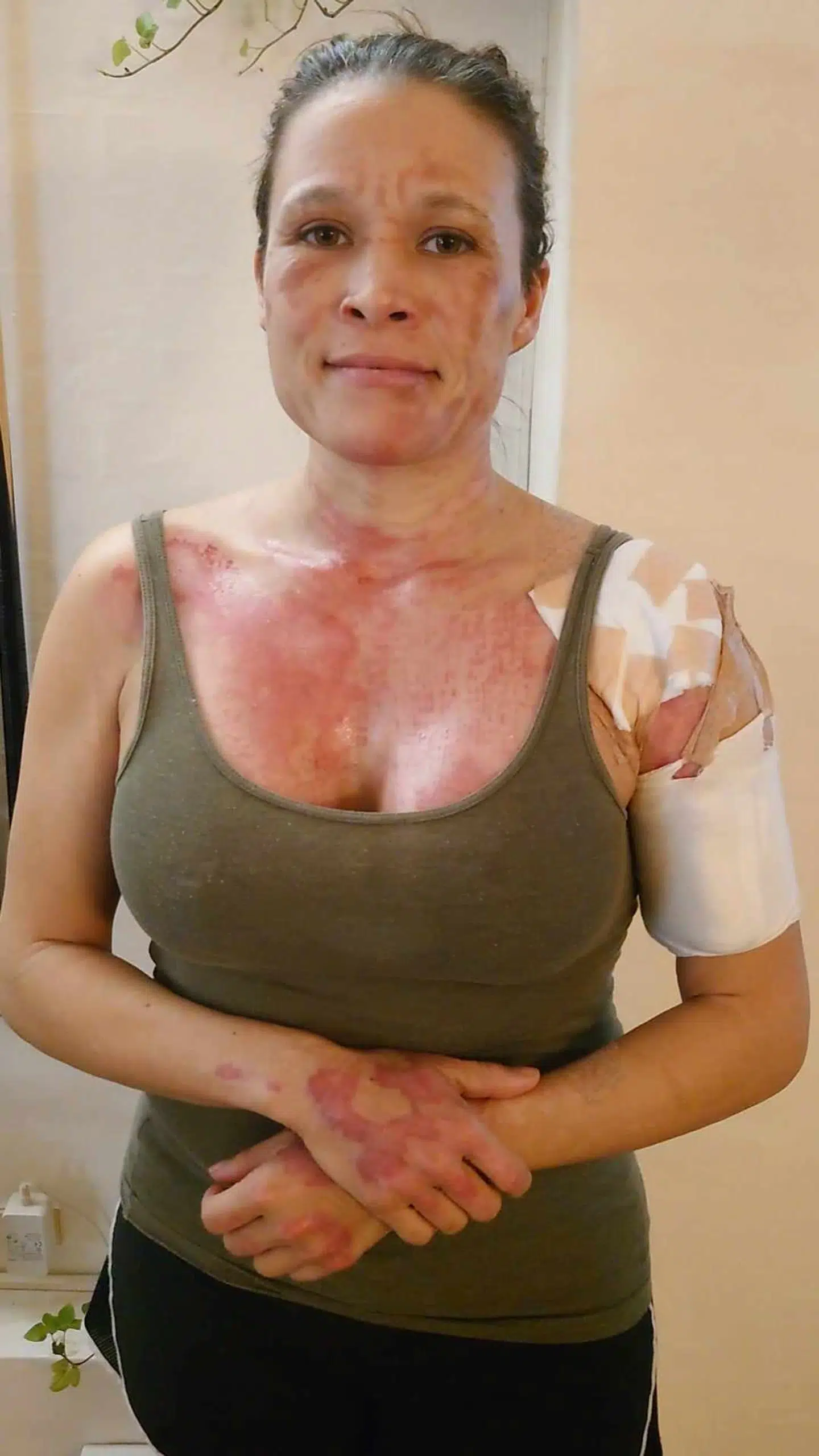 Sådan ser Annemette ud i dag