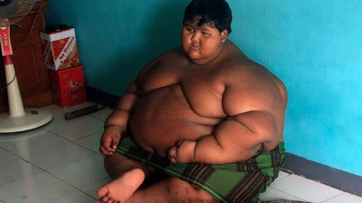 Sådan så Arya Permana fra Indonesien ud, da han var 10 år gammel. Han vejede næste 200 kilo.