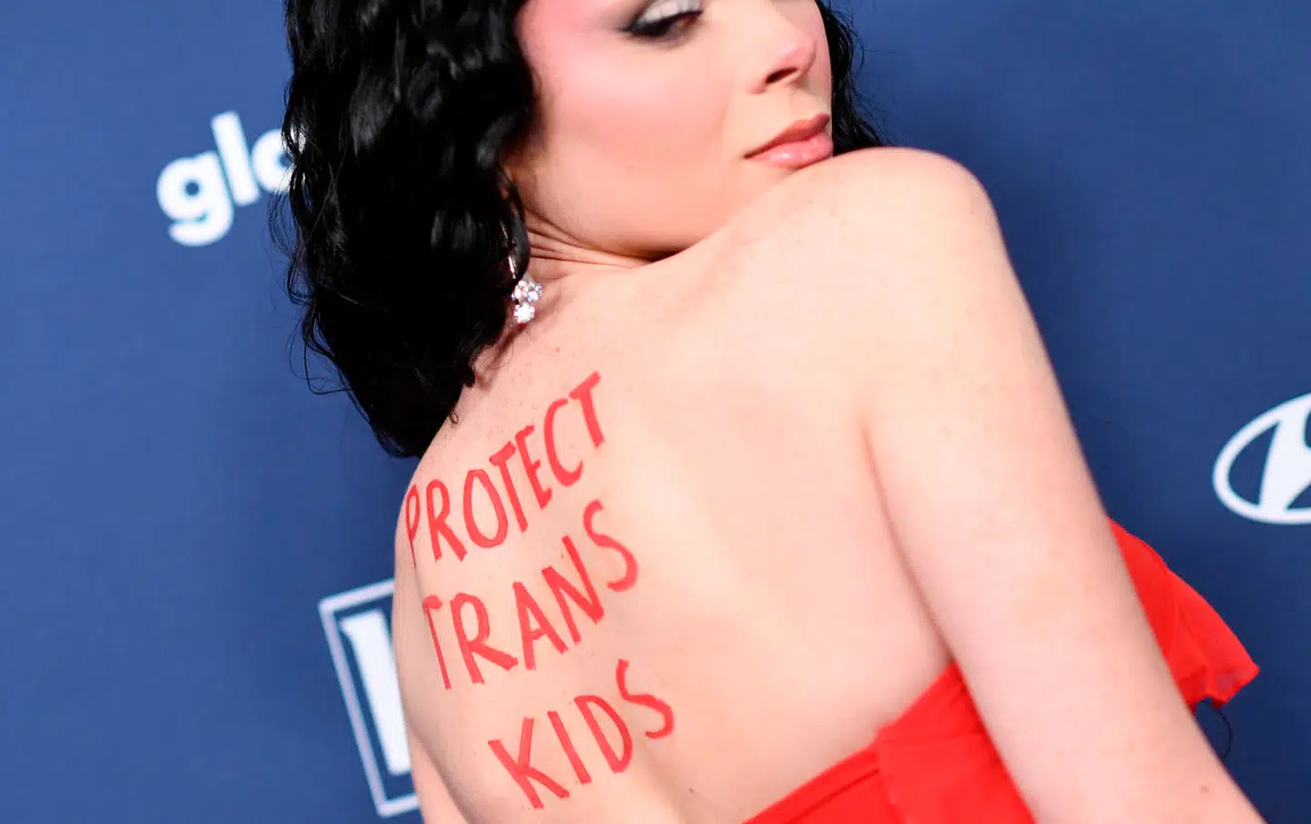 Man har gjort personer, der reelt lider af kønsdysfori en bjørnetjeneste, da man underkender den lidelse, de rent faktisk oplever, skriver Lasse Sørensen. Den amerikanske social media-personlighed Samantha Lux bærer her ordene »Protect Trans Kids« på ryggen.