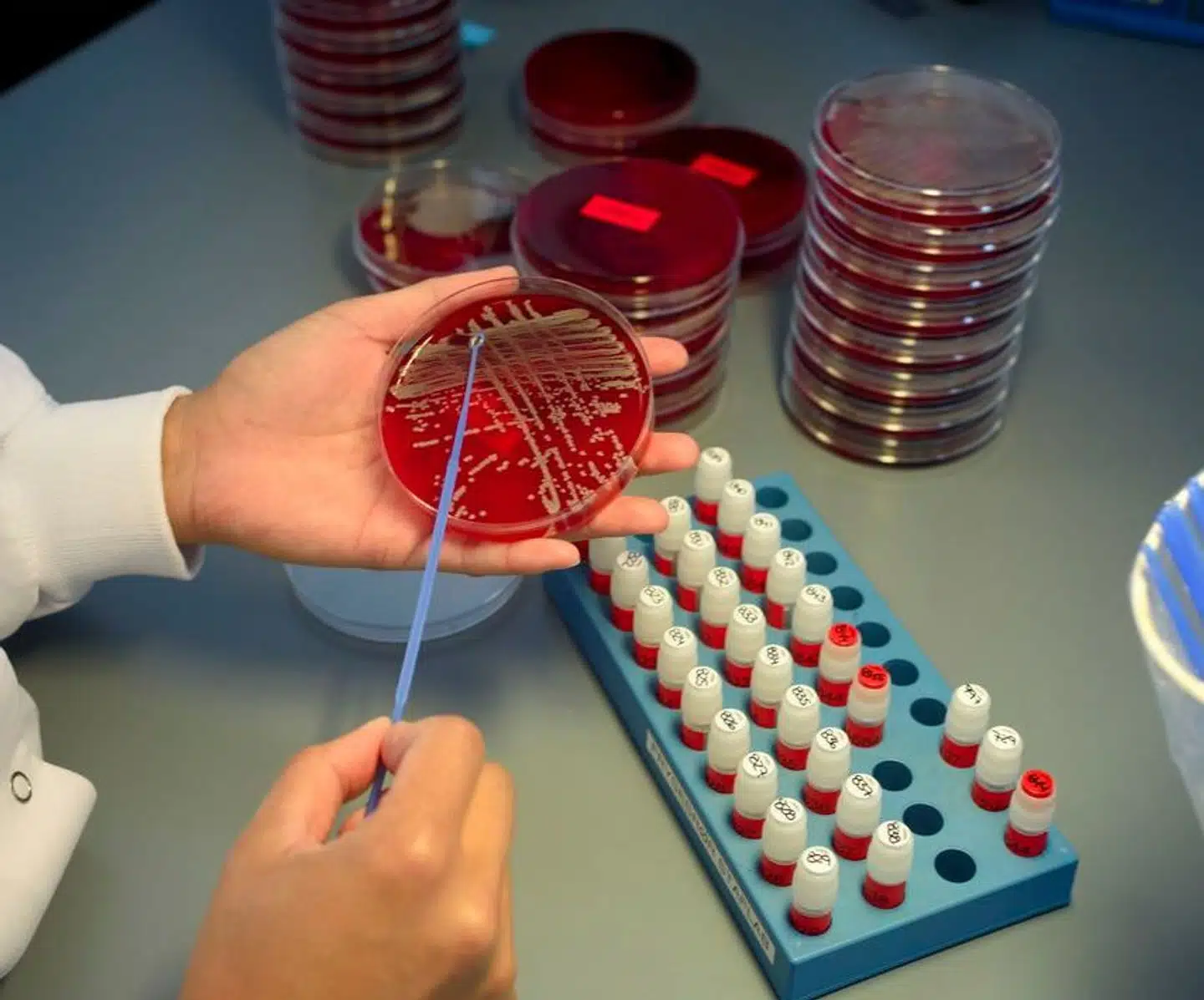 Statens Serum Institut har undladt at informere tre millioner danskere om, at deres biologiske prøver opbevares i Danmarks Nationale Biobank. I en pressemeddelelse 8. april skrev SSI, at danskerne nu ville få besked. Det fremgik dog ikke af SSIs pressemeddelelse, at det var Datatilsynet, som i en principiel afgørelse havde pålagt SSI at give besked.