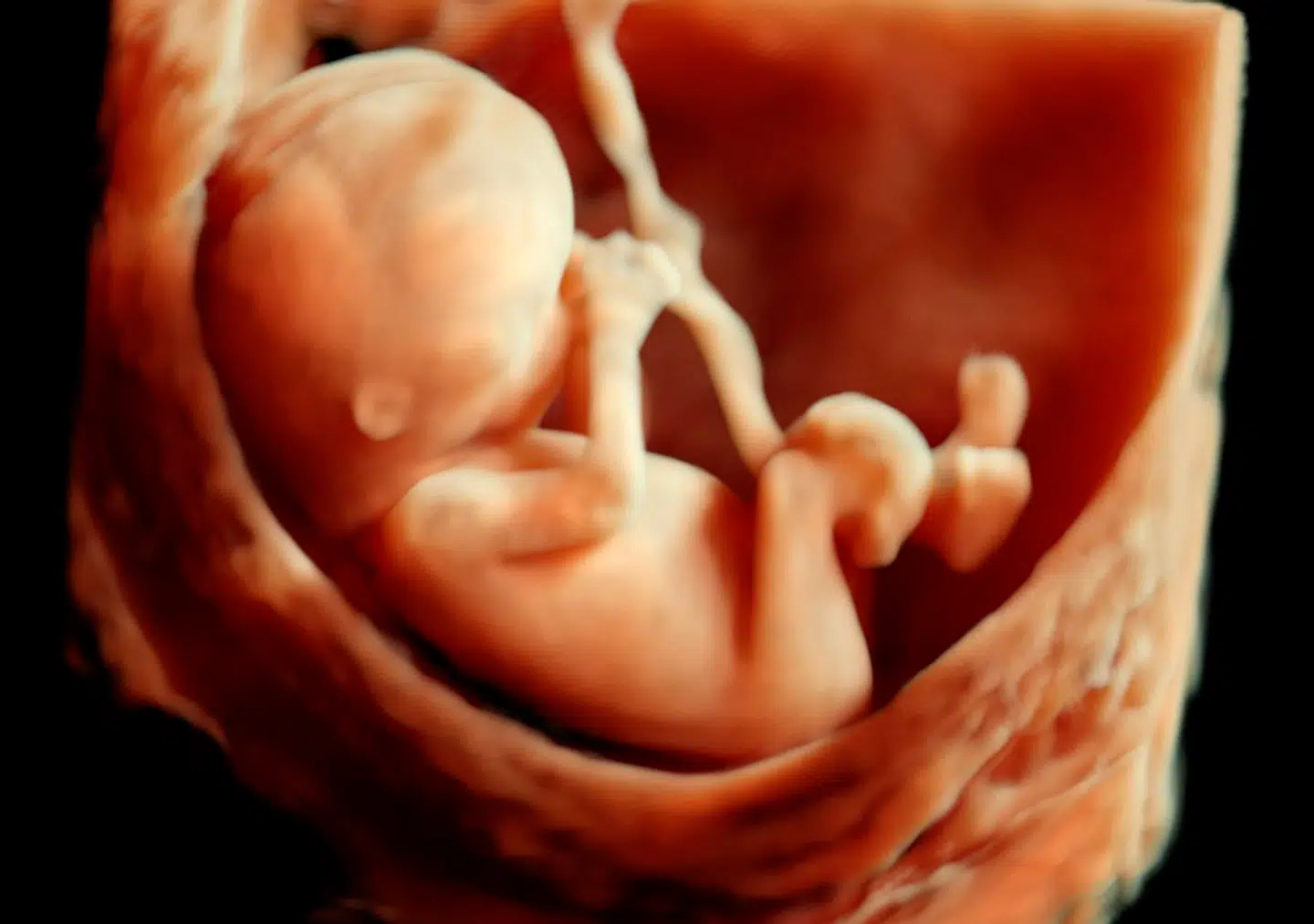 Et lækket aftaleudkast viser, at flere partier ønsker at forhøje abortgrænsen til 18. uge.