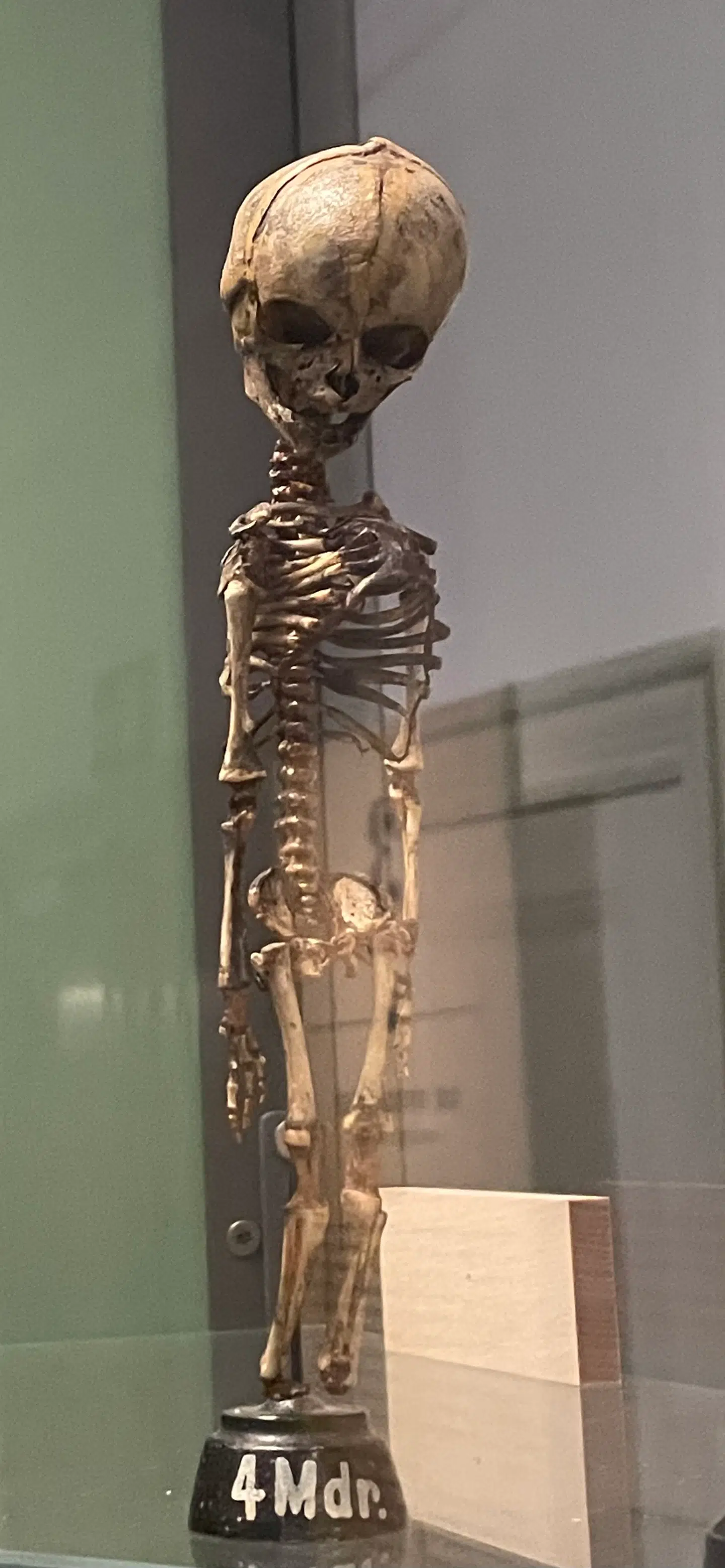 Skelet fra foster på fire måneder. Udstillet på Medicinsk Museion som en del af en større udstilling, der ikke handler om abortgrænsen.