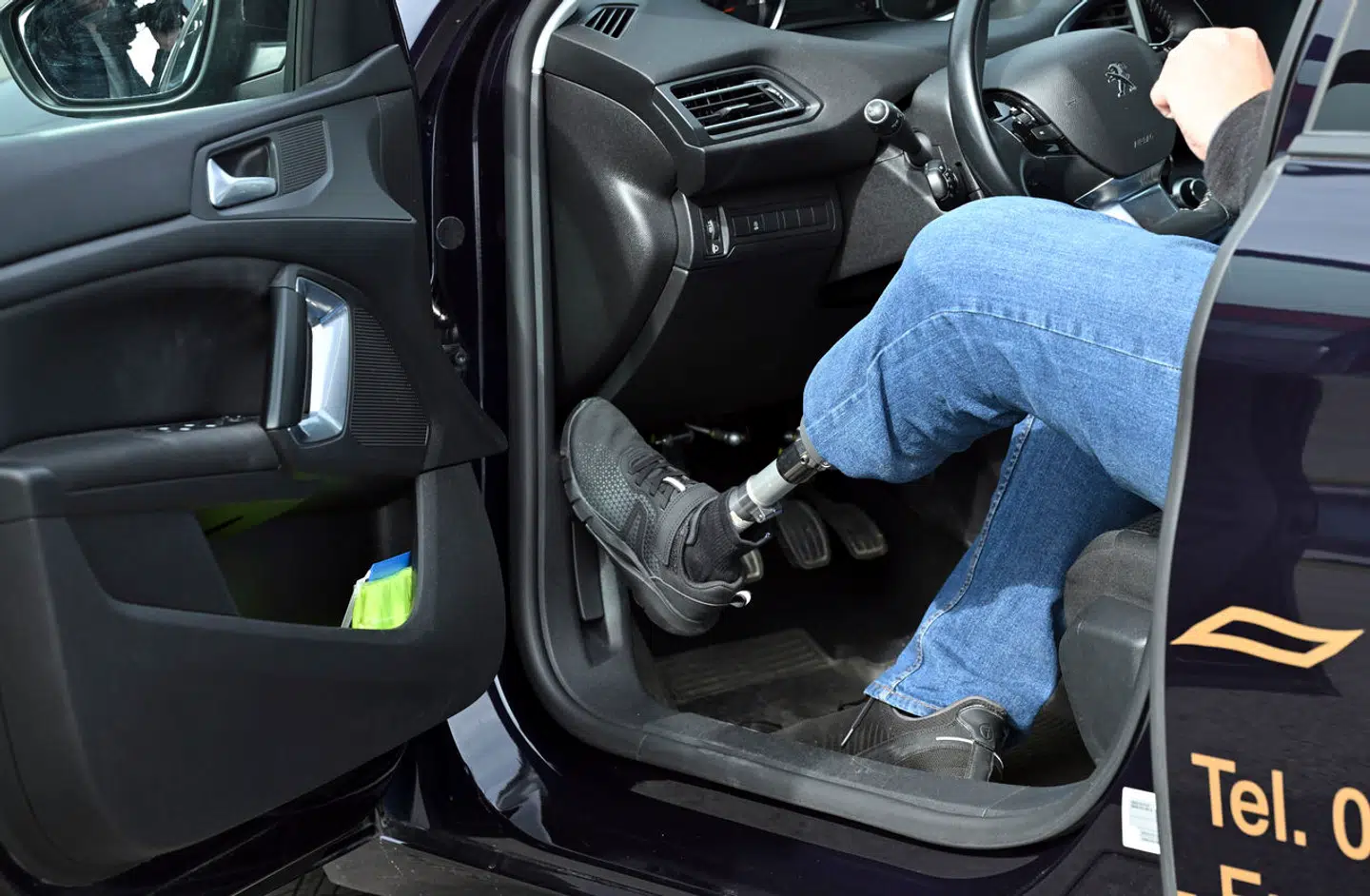 Amputationsskandalen fra 2022 begynder nu at udløse erstatninger til en stribe patienter, der har oplevet for sen og for dårlig behandling.