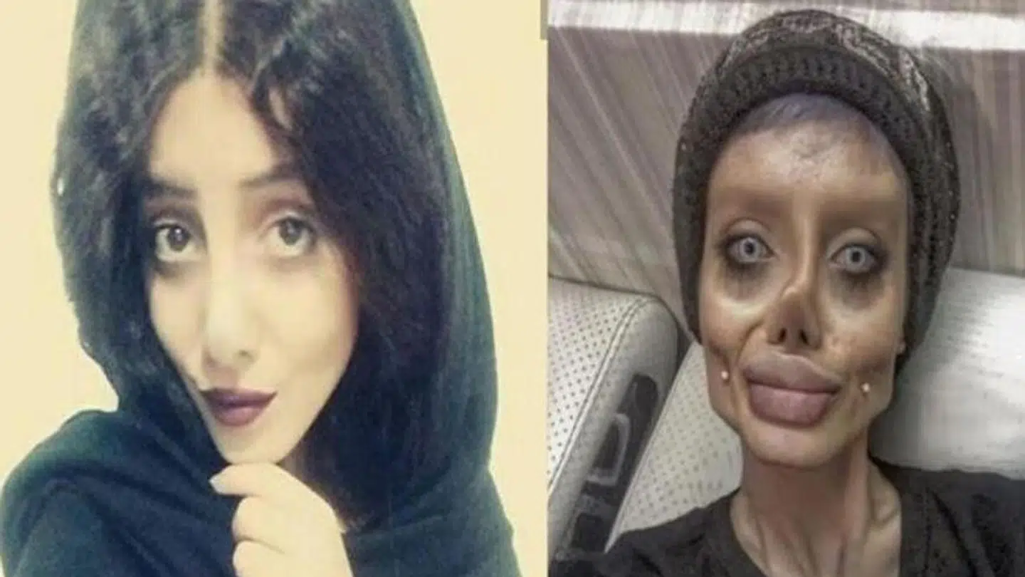 Sahar Tabar (tv.) forsøger at ligne Angelina Jolie på det midterste billede.