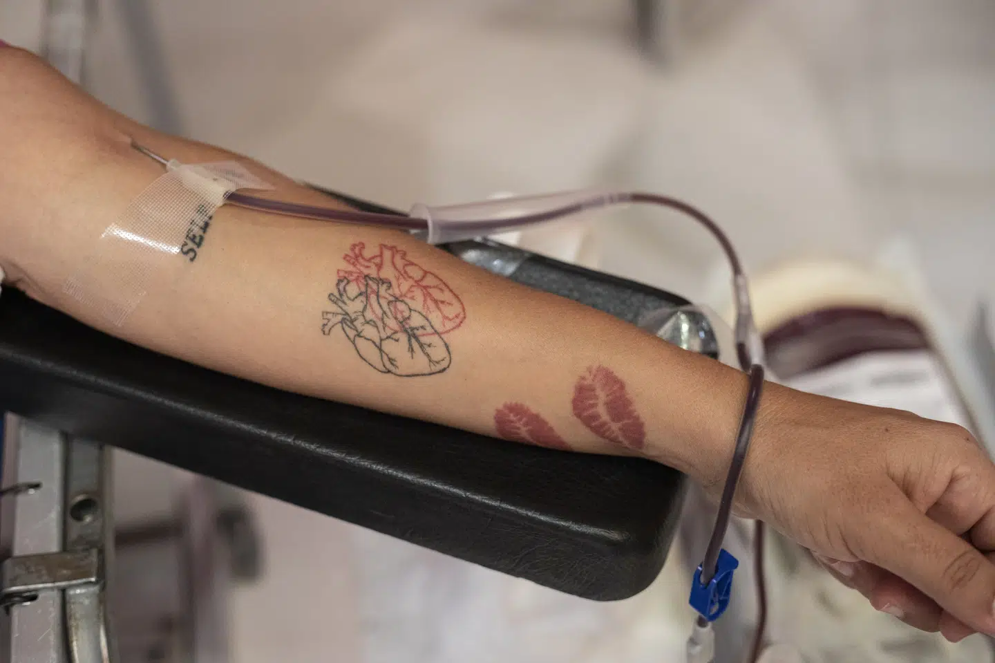 Blandt andet blodtransfusioner er ramt af it-hændelse i Storbritannien. (Arkivfoto).