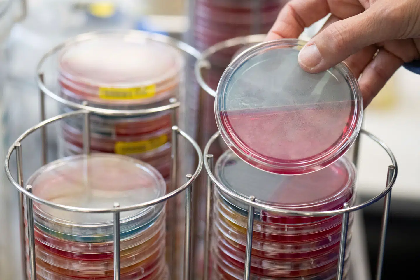 Det sjældne fænomen skyldtes en ubalance i kvindens mikrobiom. Arkivfoto: Boris Roessler, Scanpix