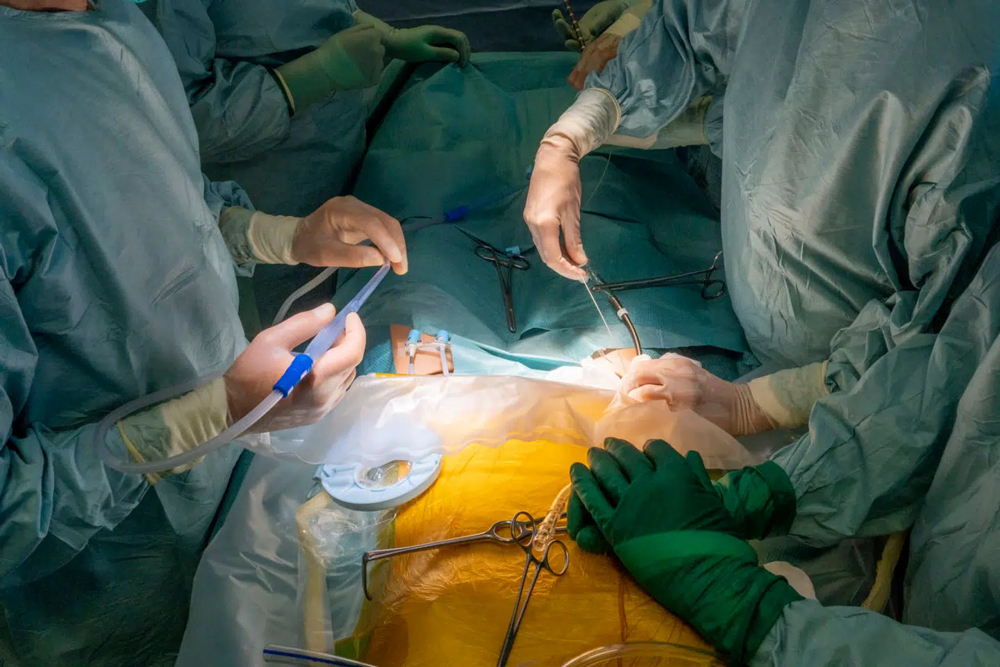 »Mange af de operationer og behandlinger, patienterne ønsker for at mindske lidelserne og komme tilbage på arbejdsmarkedet, er rationerede,« skriver Niels Jørgen Langkilde.