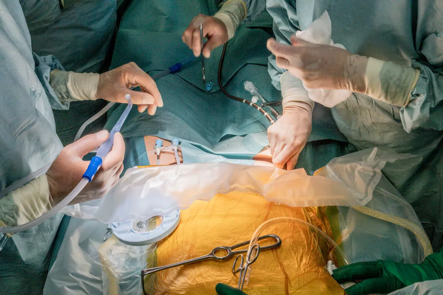 442 kritisk syge patienter ventede i 2023 på et nyt organ. Heraf ventede 373 på en nyre, og med et nyt udspil er håbet nu, at alle efterhånden vil kunne få én.