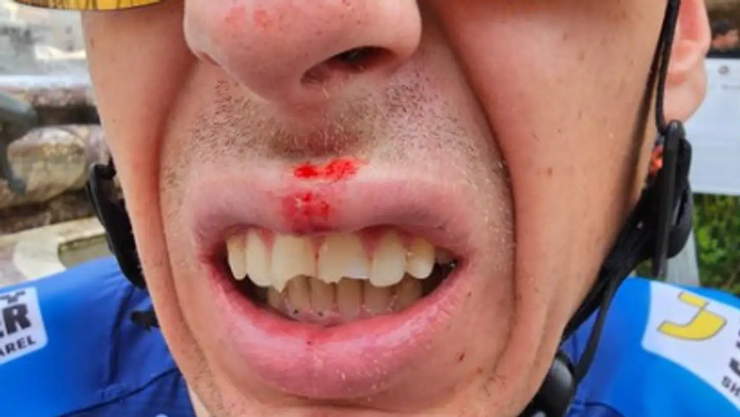 En forslået Jan Hirt, som alligevel stiller til start ved årets Tour de France.