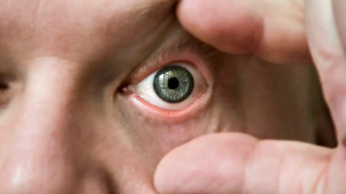 Professor i øjensygdomme giver ikke meget for behandlingstilbud.