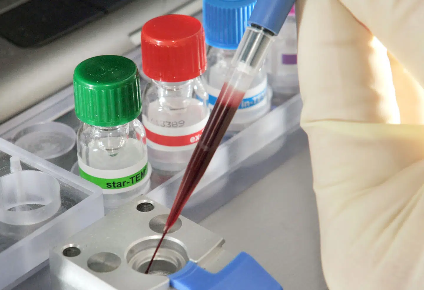 Arkivfoto: Jan-Peter Kasper, Scanpix