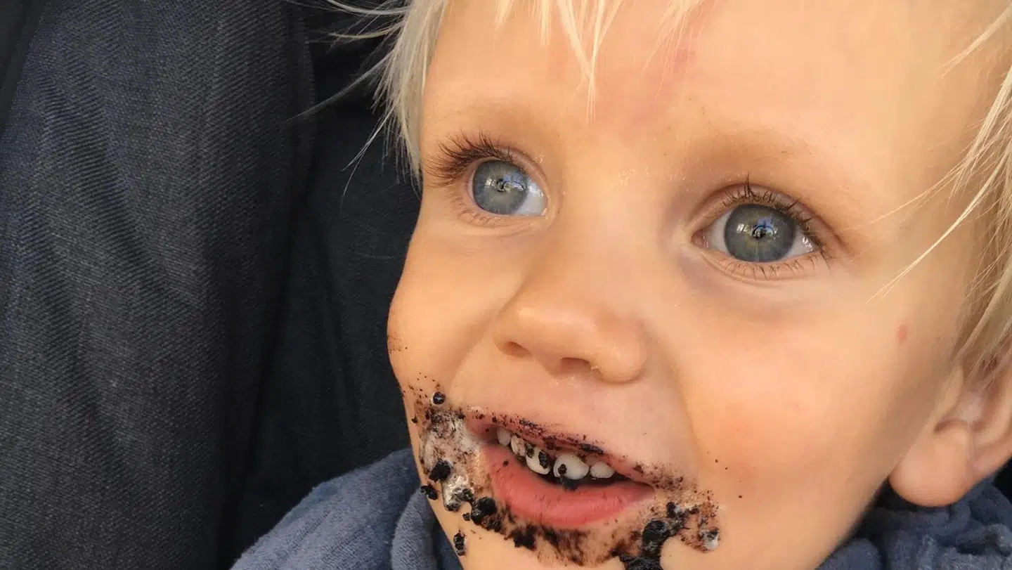 Karl er født med et storkemærke i panden. Efterhånden som han er blevet ældre, er mærket blevet mindre synligt. Foto: Privat.