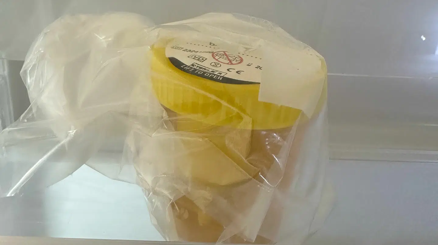 Steen Arne Vilquin kunne til sin store ærgrelse finde sin 98-åriges svigermors urinprøve i køleskabet måneder efter, den var blevet taget for en mistanke om en urinvejsinfektion.