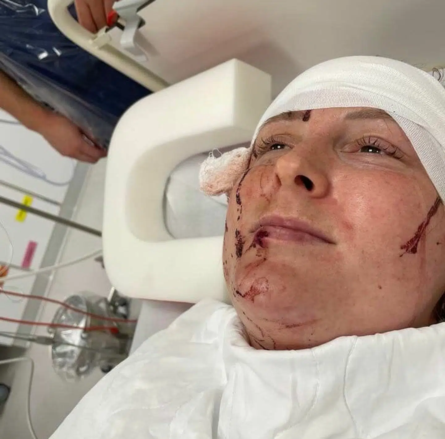 Laura kom en tur på hospitalet efter sit mød med koen. Heldigvis slap hun uden alvorlige skader.