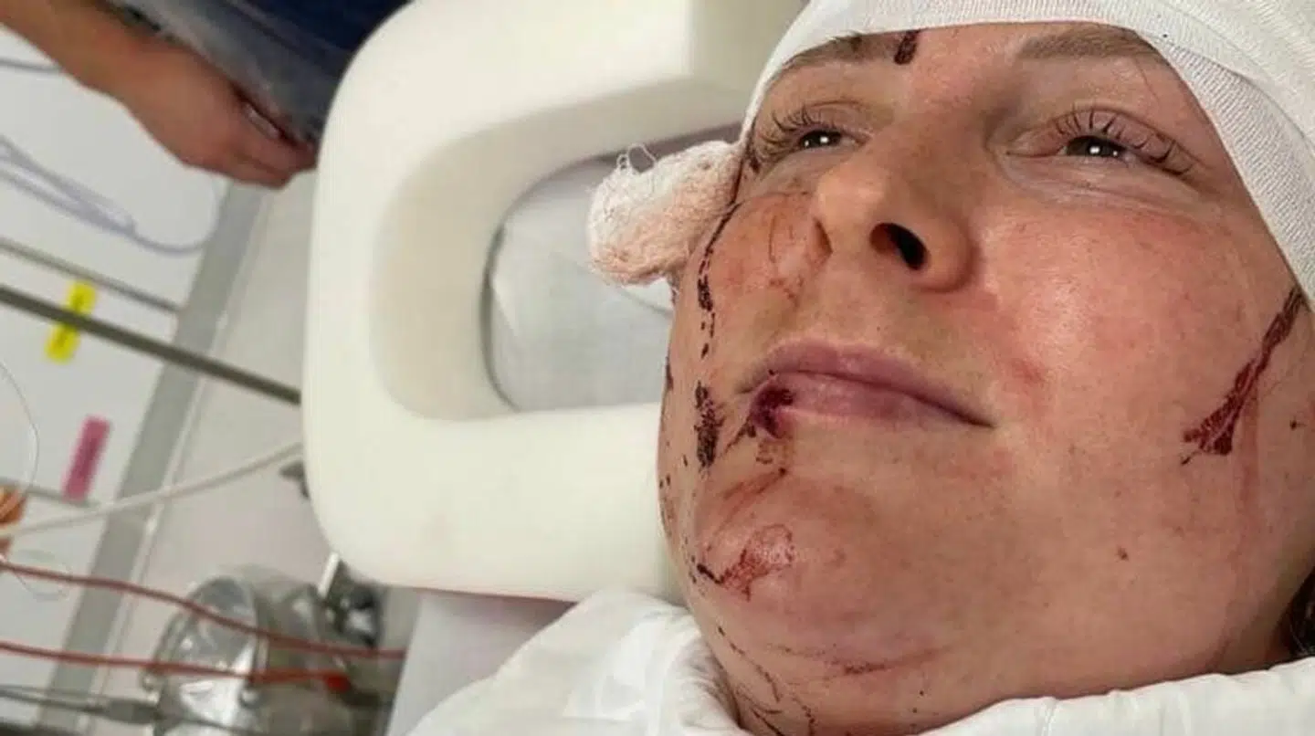 Laura kom en tur på hospitalet efter sit møde med koen. Heldigvis slap hun med livet i behold.