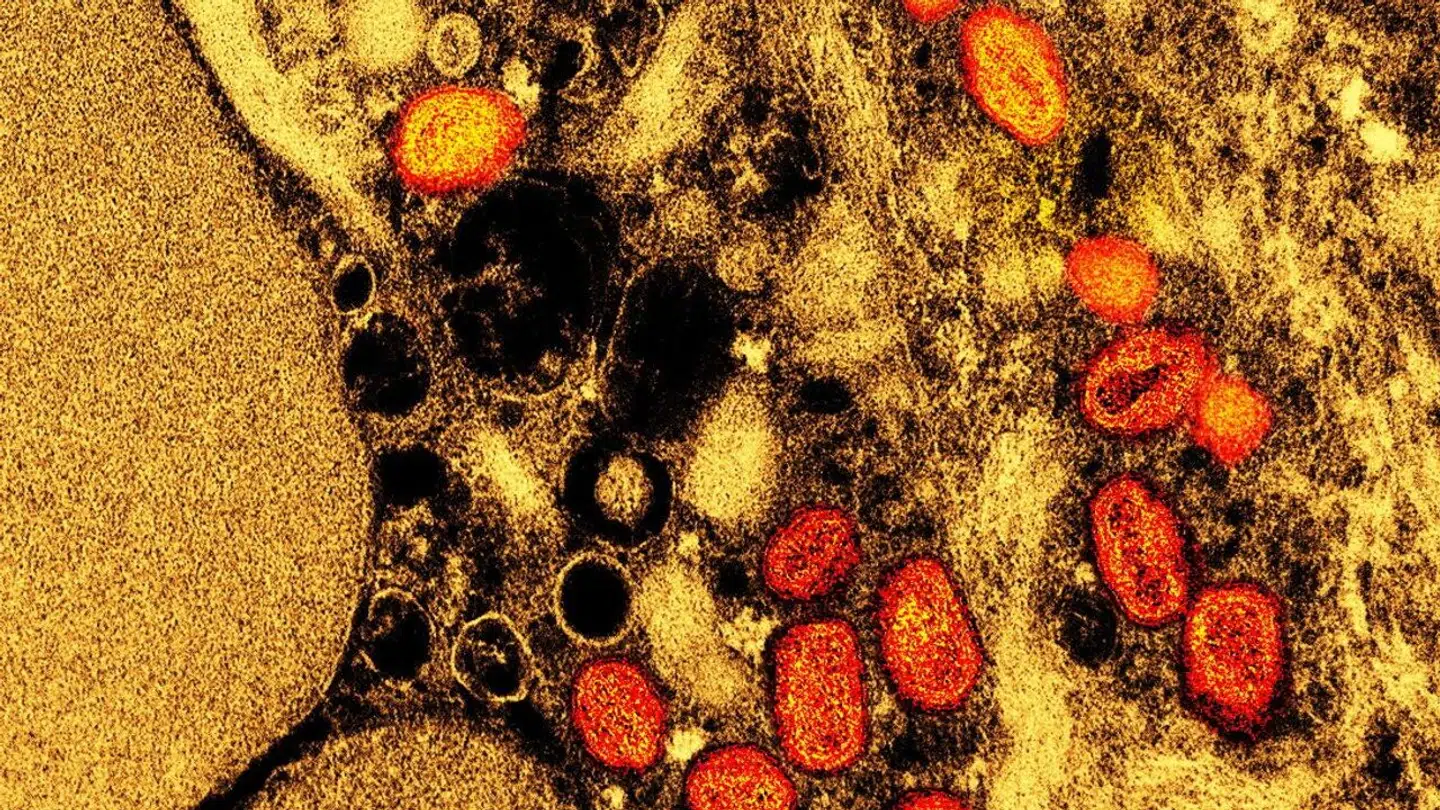 Mpox spreder ændrer og spreder sig for hurtigt, siger eksperter.