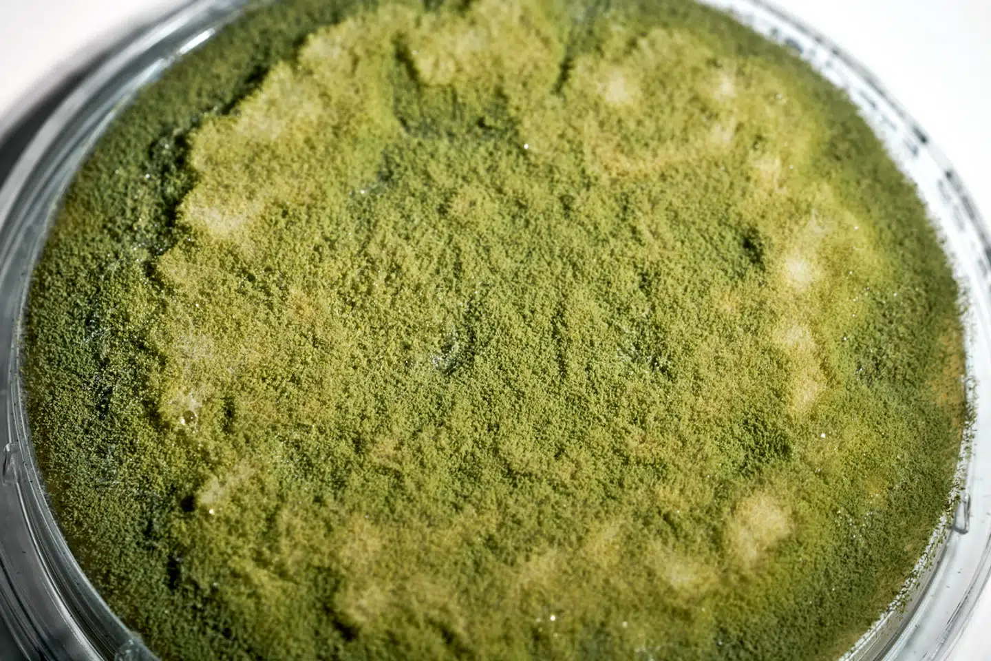 Der er mange tusind slags skimmelsvamp. Denne, som er fundet hos 28 personer, hedder Aspergillus flavus. De fleste af de syv børn, som pludseligt blev syge mellem 2017-2019, var smittet med denne svamp