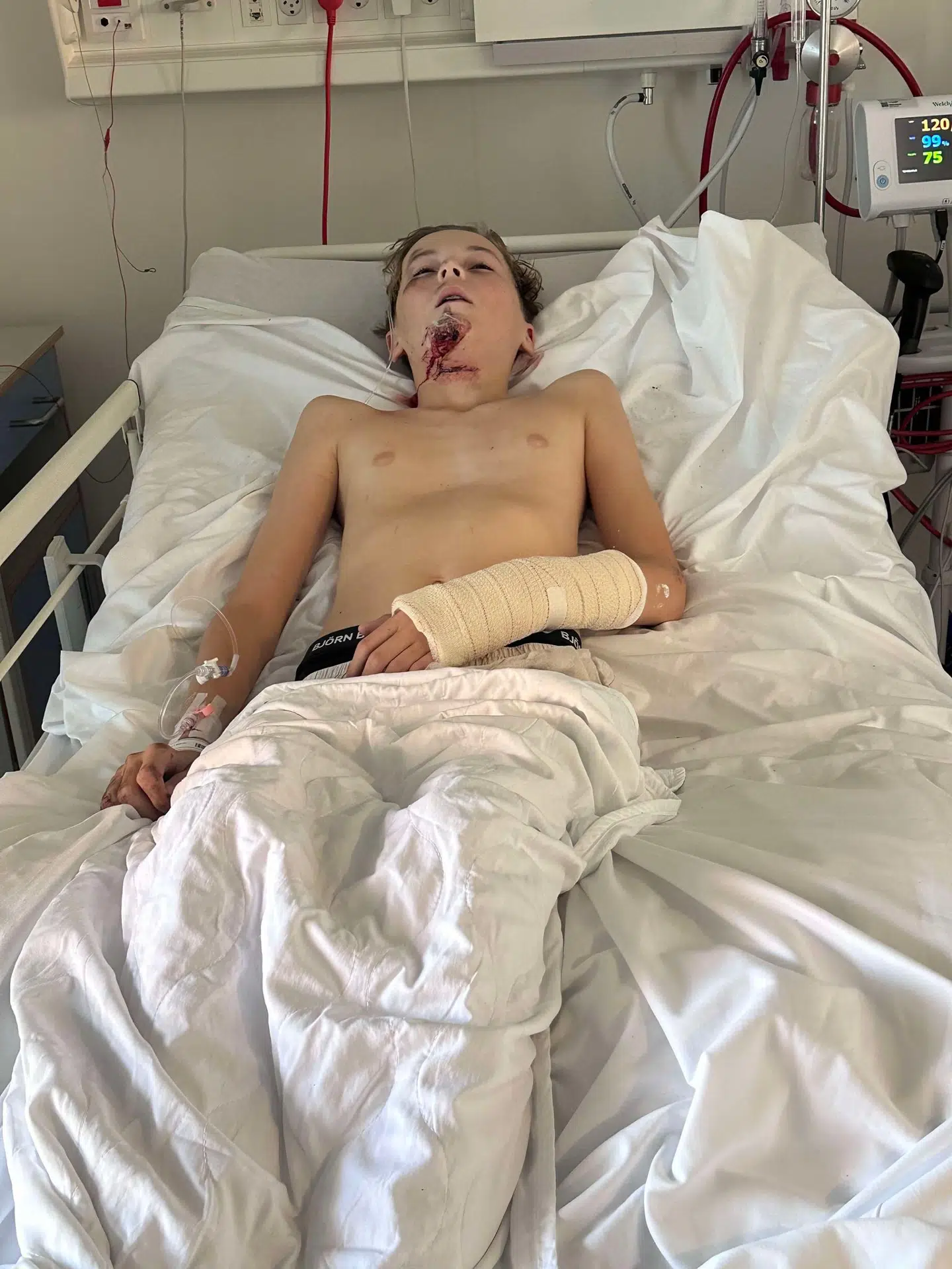 13-årige Noah kom alvorligt til skade, da han i sidste uge kom kørende på sit el-løbehjul og ramte en såkaldt soldaterfod i en mørk tunnel. Nu er hans forældre ude med et klart budskab.