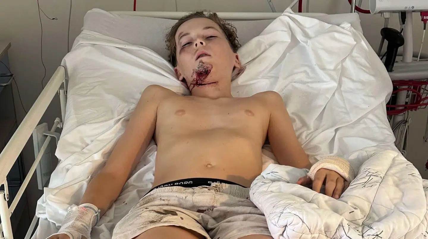 13-årige Noah kom alvorligt til skade, da han i sidste uge kom kørende på sit el-løbehjul og ramte en såkaldt soldaterfod i en mørk tunnel. Nu er hans forældre ude med et klart budskab.