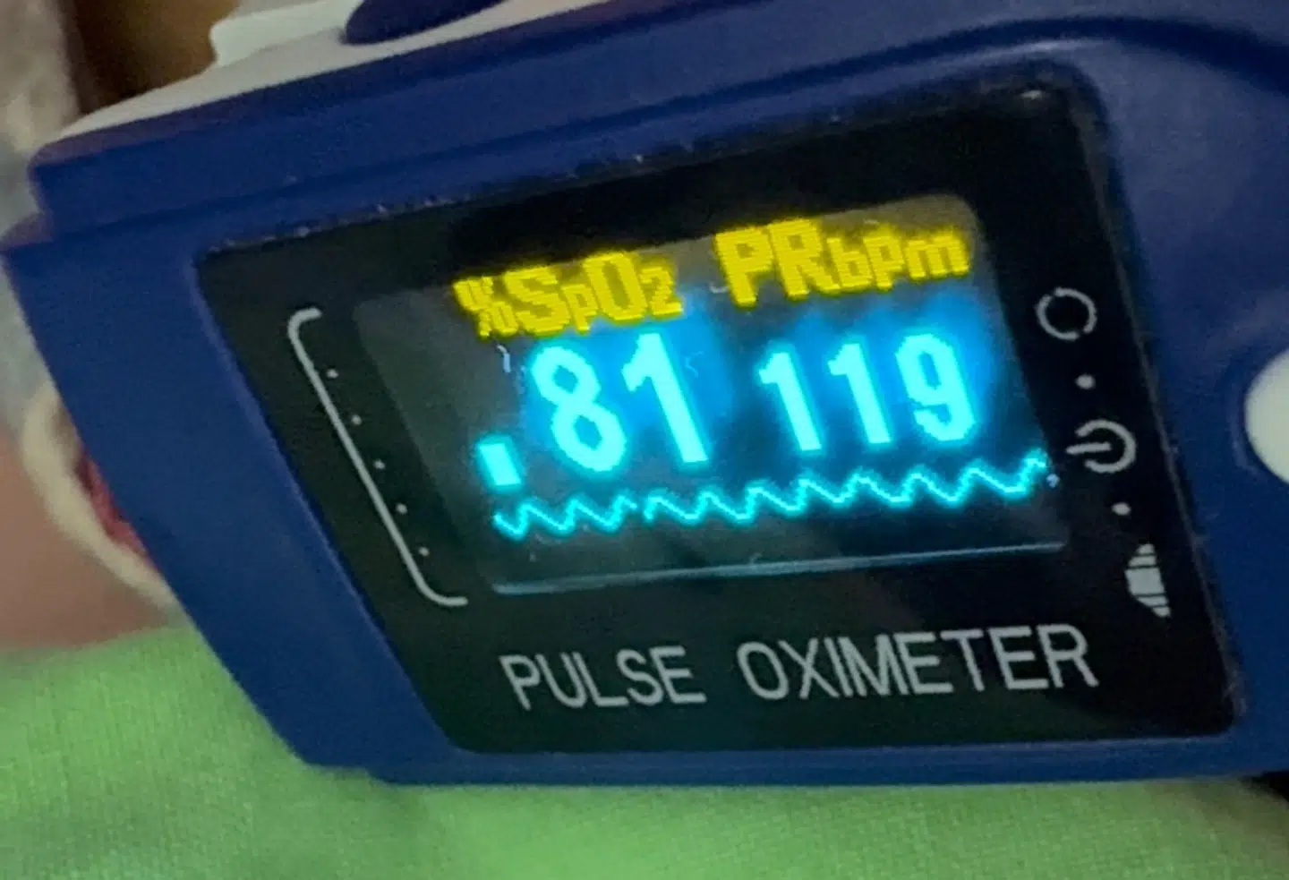 Viljes iltmætning af blodet når undervejs ned omkring 80 procent.