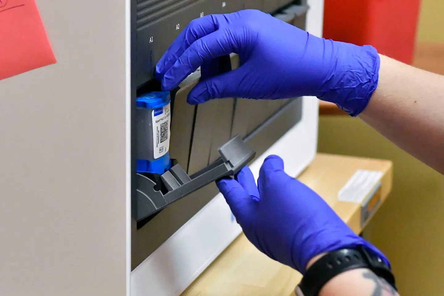 En laborant foretager en test for hepatitis C og hiv.