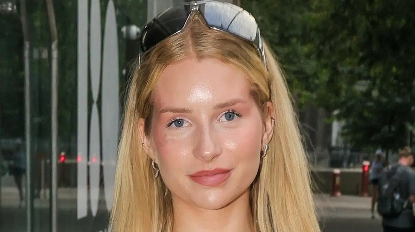 Lottie Moss vil gerne advare andre.