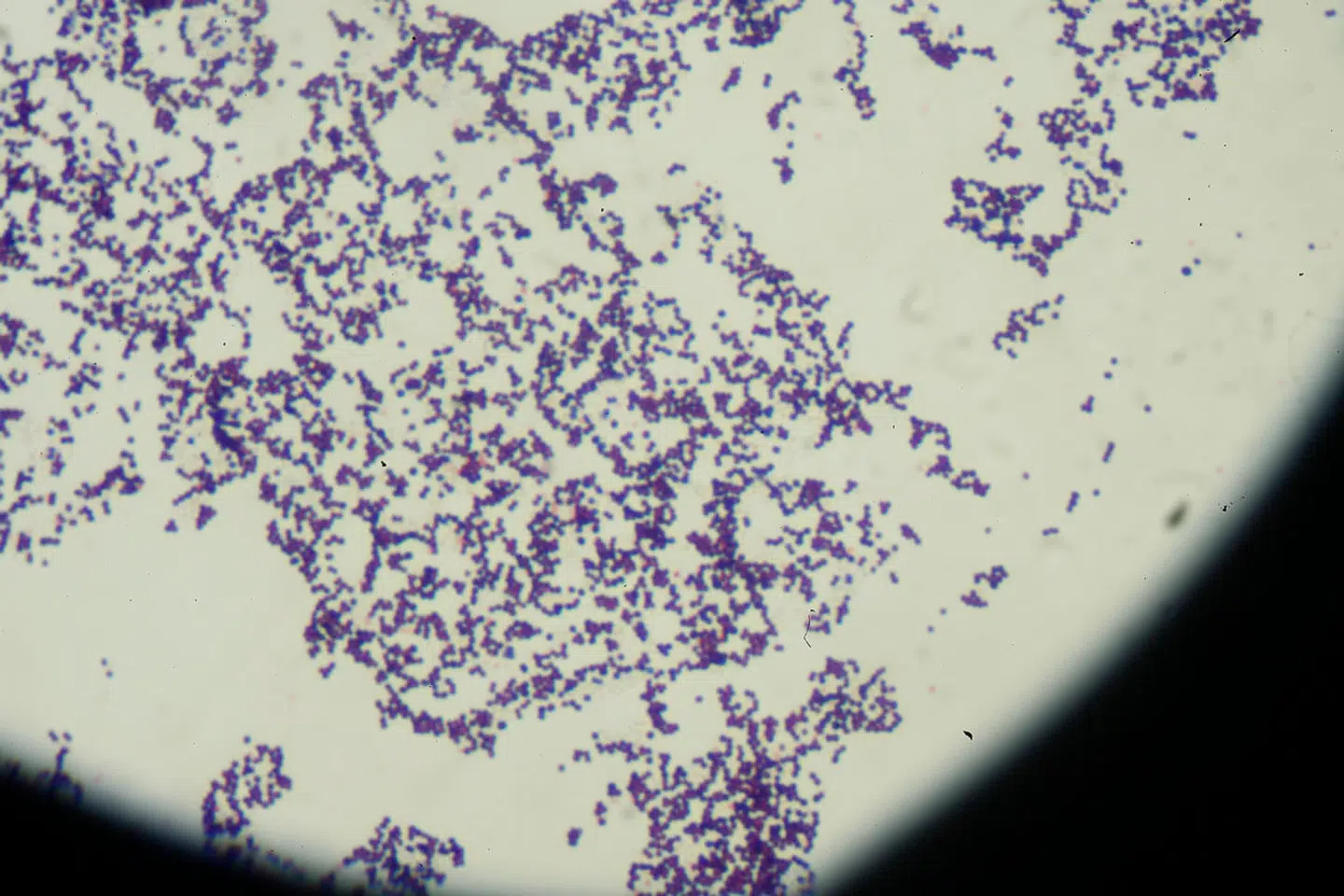 Antibiotikaresistente bakterier er en af de største trusler mod verdens befolkning. Arkivbillede af bakterier.