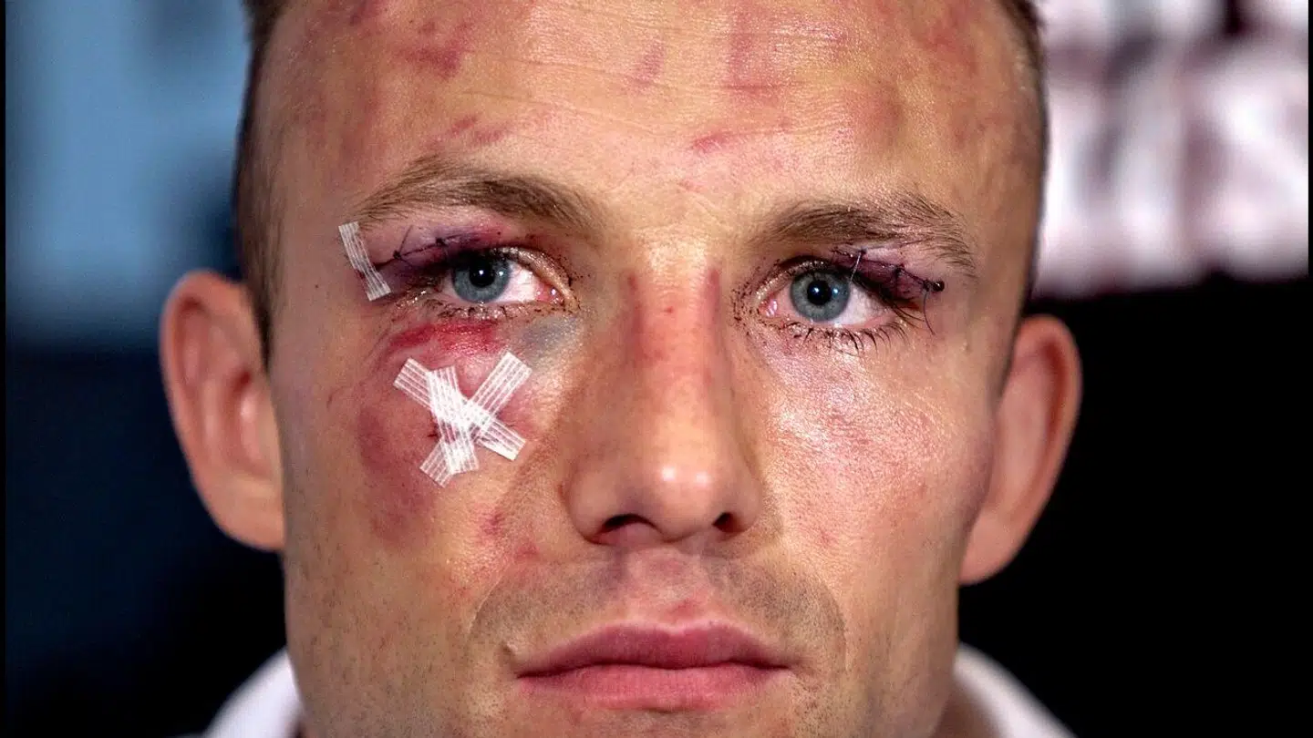 Mikkel Kessler var en forslået mand efter kampen mod Andre Ward.