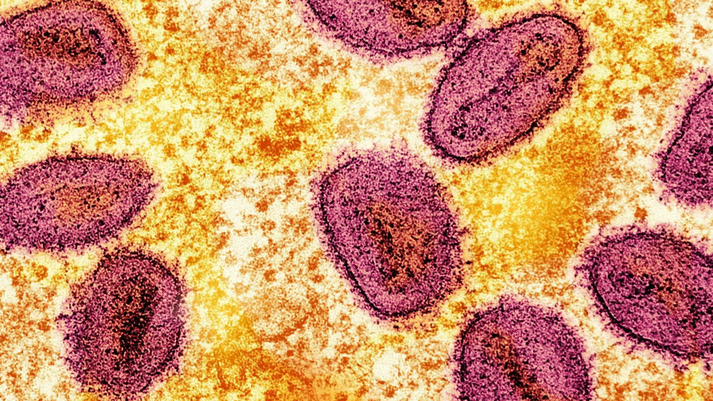 En 33-årig mand fra Köln er blevet smitet med mpox.