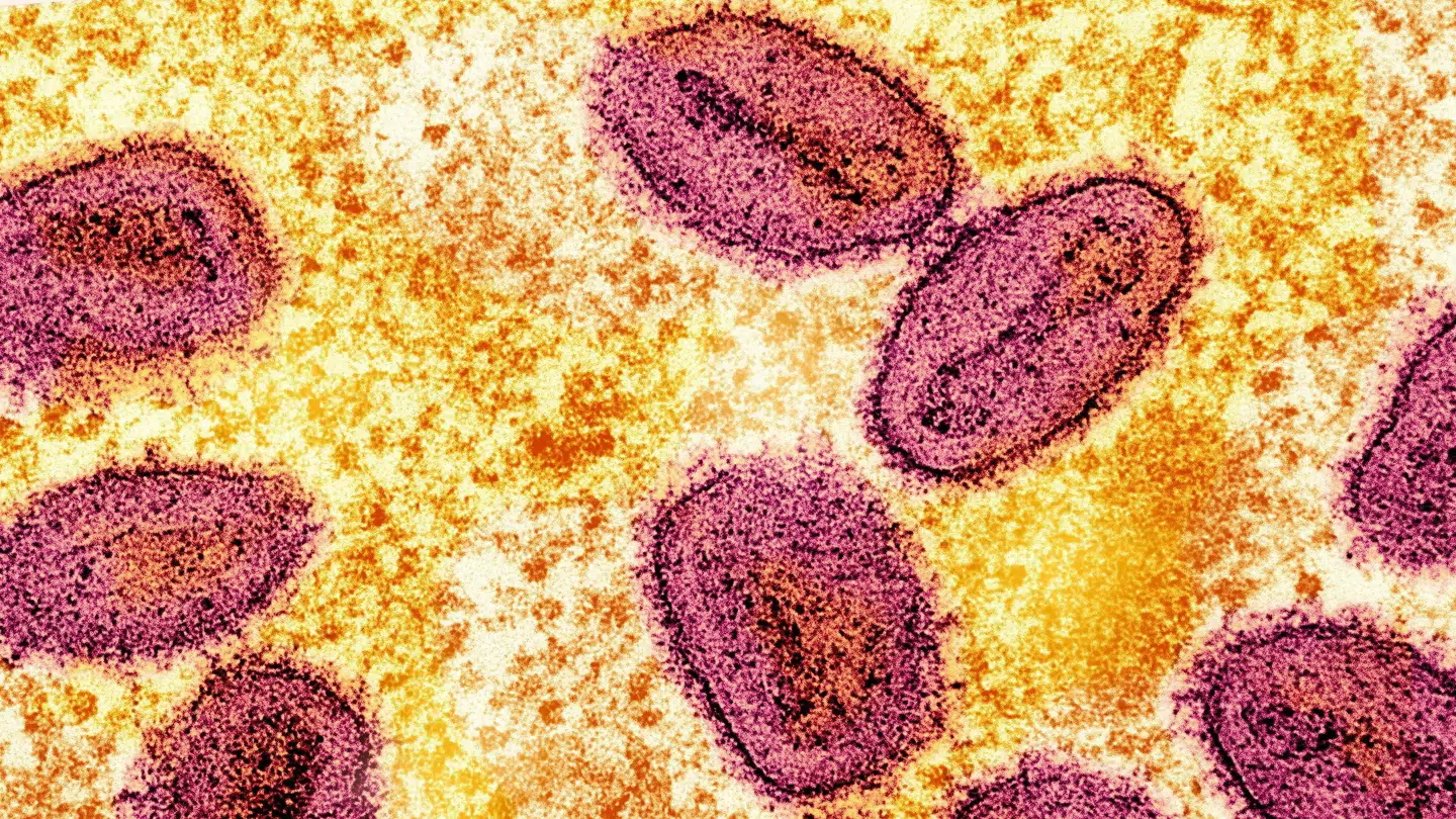 En 33-årig mand fra Köln er blevet smitet med mpox.