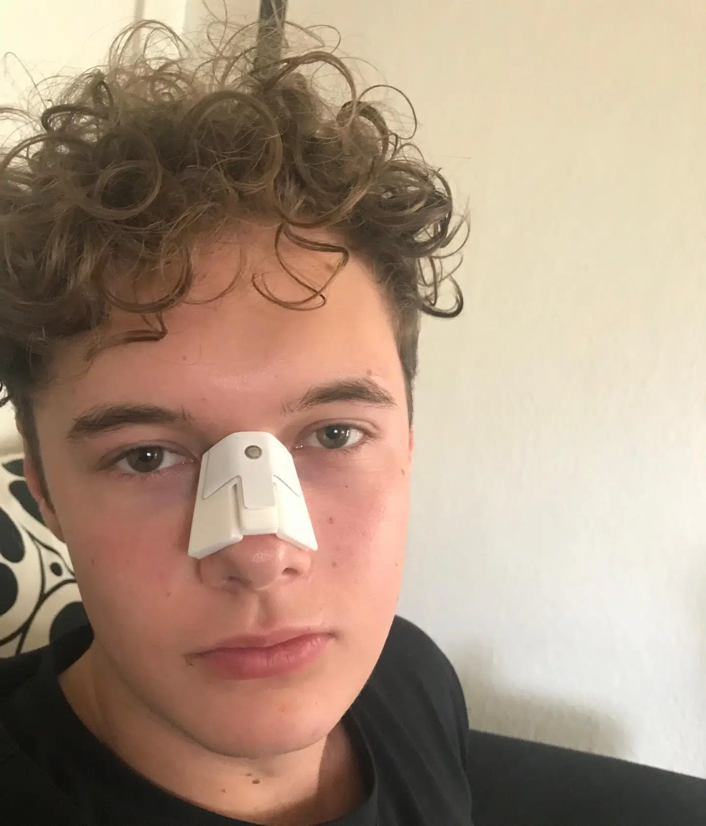 For Silas Lund endte en bytur i København med en brækket næse, en hjernerystelse og flere tandskader. Hele 532 dage gik der fra anmeldelse til Københavns Politi, til selve dommen for vold blev afsagt 12. september 2019. Den voldsdømte slap så for fængsel grundet ventetiden. Foto: Privat
