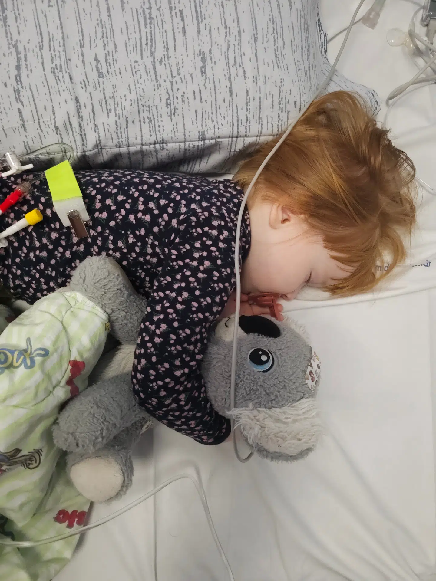 Mille på opvågning efter narkose, hvor hun har fået kemobehandling hun og sonde for 2. Gang