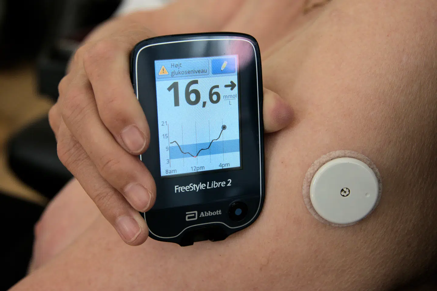 Da David Ludwig begyndte at tage på i vægt, begyndte han at måle sit blodsukker.