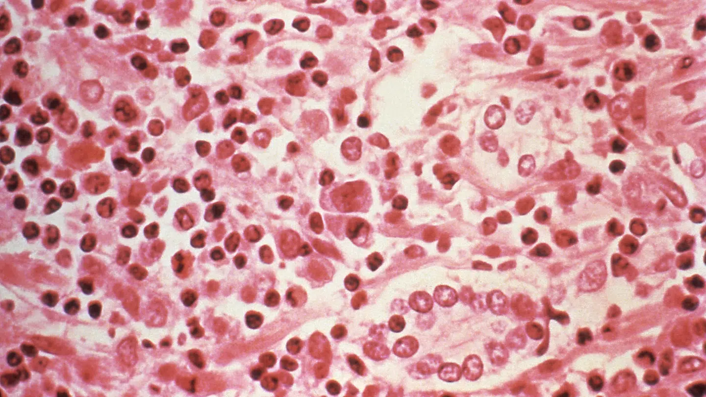 Der er blandt andet hantavirus i blandt de hætteglas, der er forsvundet.