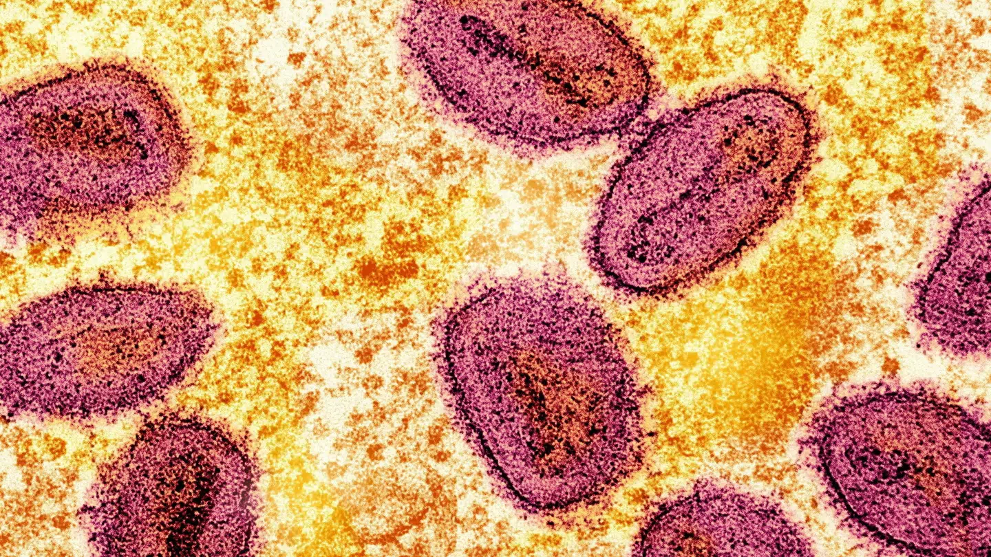 To skoleelever er blevet smittet med mpox i en tysk skole. Det får nu konsekvenser.