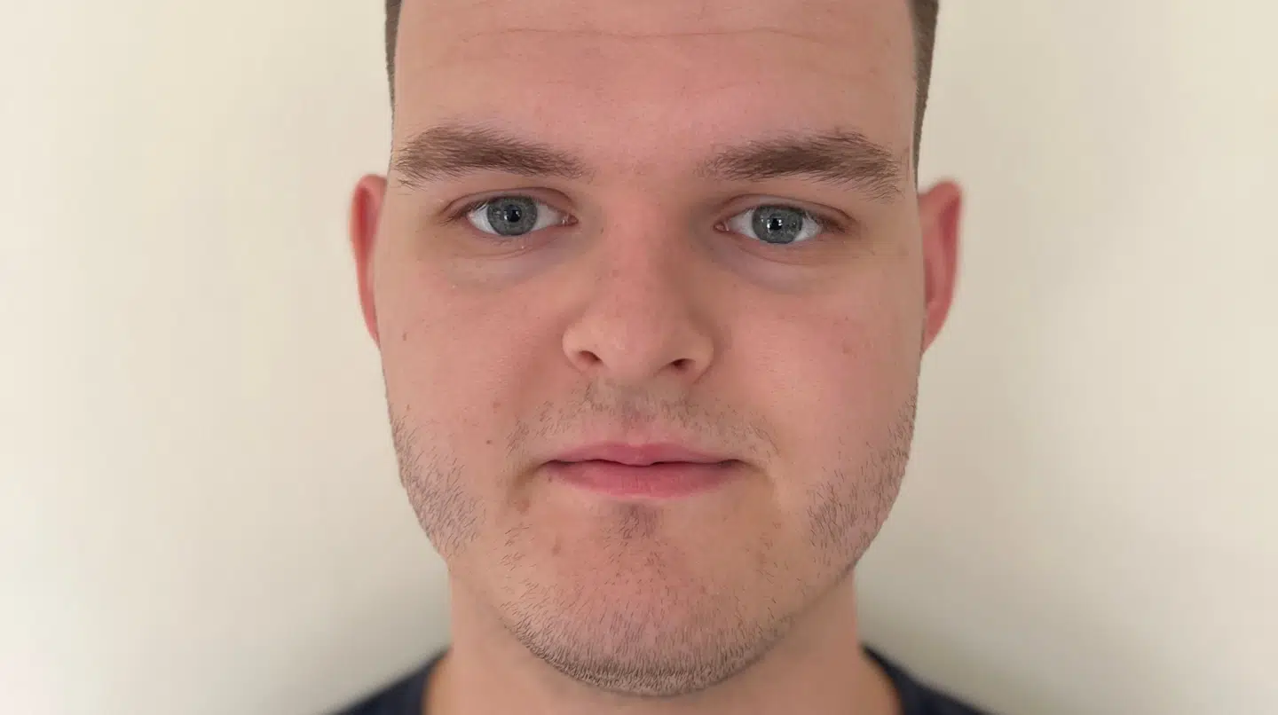 Alexander Gislund er trist over dagens aktiedyk.