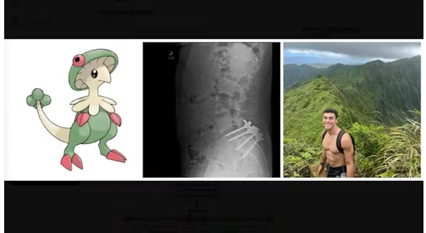 Kollagen fra Luigi Mangiones profil på X.