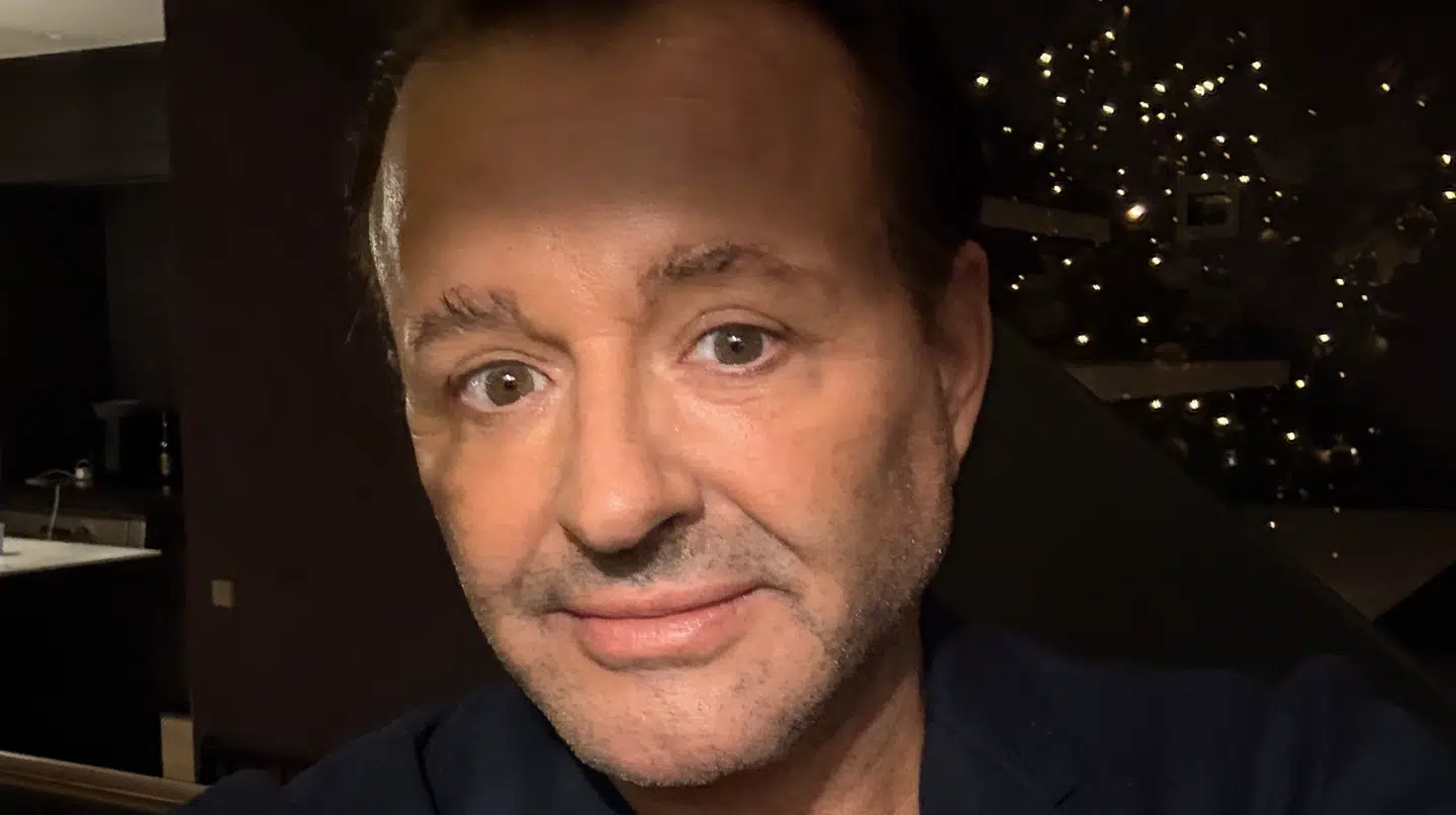 Dennis Knudsen kan ikke længere fløjte efter sit ansigtsløft. Foto: Privat